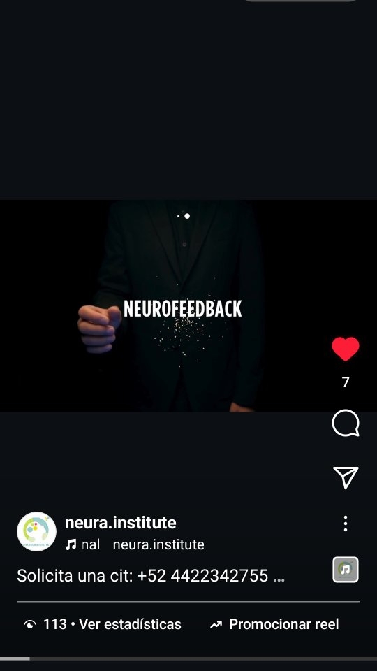 Solicita una cit: +52 4422342755