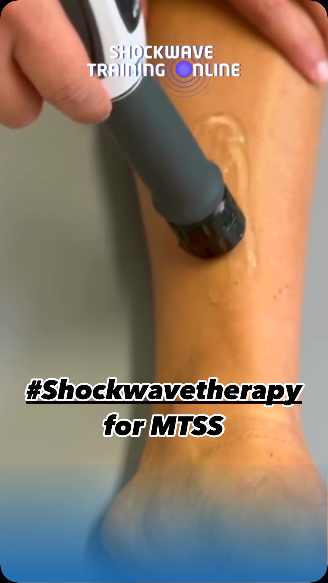 Want to master shockwave therapy without the overwhelm?
Join our online course designed to simplify learning for healthcare professionals.
Learn shockwave in just half a day – all for only £99!
Perfect for busy clinicians ready to level up their skills.
Enroll now and start treating with confidence!
#ShockwaveTherapy #HealthcareProfessionals #PhysioLife #MSKtraining #OnlineCourse #CPD #PhysicalTherapy #ChiroLife #SportsTherapist #MedEd #ShockwaveMadeSimple #HalfDayCourse