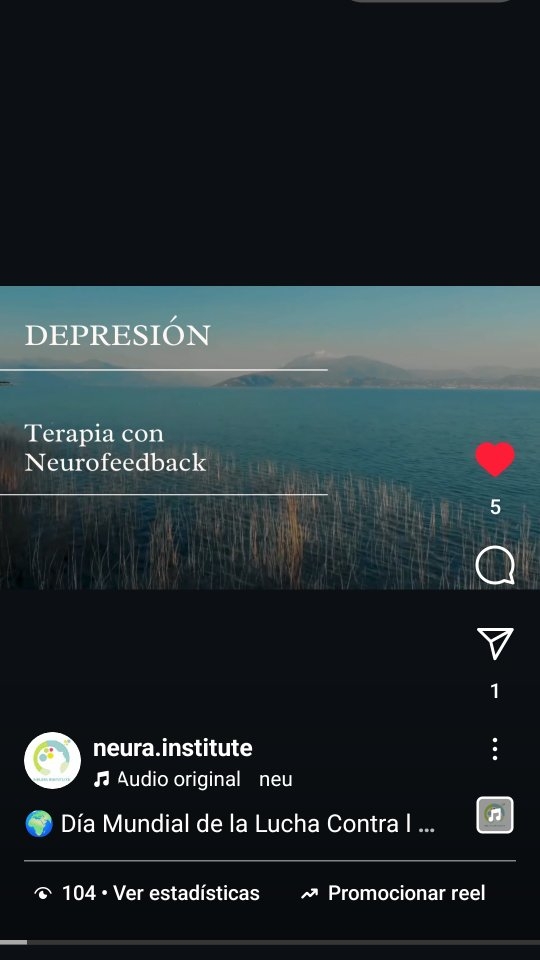 🌍 Día Mundial de la Lucha Contra la Depresión 💙
Hoy es un día para reflexionar y hablar abiertamente sobre un tema que afecta a millones de personas en el mundo: la depresión.
¿Cómo se siente una persona con depresión?
La depresión va más allá de sentirse triste. Puede manifestarse como:
Pérdida de interés en actividades que antes disfrutabas.
Dificultad para concentrarte o tomar decisiones.
Cambios en el sueño (insomnio o dormir en exceso).
Falta de energía o fatiga constante.
Sentimientos de inutilidad, culpa o desesperanza.
Pensamientos recurrentes de muerte o suicidio.
💡 La esperanza existe: La ciencia ha avanzado, y ahora contamos con herramientas innovadoras para tratar la depresión. Una de ellas es la neuromodulación, un tratamiento no invasivo que ayuda a restablecer el equilibrio en las áreas del cerebro afectadas por la depresión.
🌟 Beneficios de la neuromodulación:
Mejora el estado de ánimo y la energía.
Reduce los síntomas de ansiedad asociados.
Complementa la psicoterapia y los tratamientos tradicionales.
No requiere hospitalización y es segura.
En Neura Institute, estamos comprometidos con tu bienestar. Nuestro equipo especializado está listo para acompañarte en el camino hacia la recuperación. 💙
📅 Agenda tu cita hoy mismo y da el primer paso hacia una vida con más luz y claridad. Juntos, podemos vencer la depresión. 🌱 Whatsapp +52 44 22 34 27 55
#DíaMundialContraLaDepresión #NeuraInstitute #SaludMental #Neuromodulación #Esperanza #BienestarMental #Depresión #TuSaludImporta