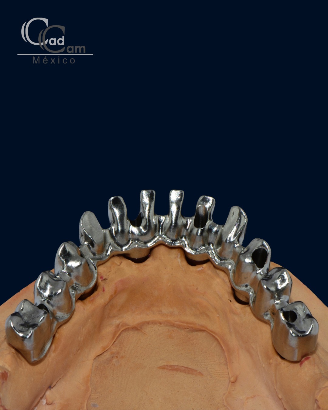Para un caso 100% en flujo digital, contacta a los expertos. Nuestro equipo de Cad Cam es líder en el mercado mexicano del flujo digital #coronas #carillas #model #smile #sonrisa #cadcam