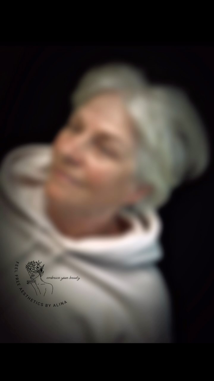 ✨Schönheit kennt kein Alter✨
Zeitlose Eleganz für meine bewundernswerte Kundin, mit fast 70 und sooo voller Lebensenergie! 🔥
Mit präzise gearbeiteten Powder Brows wird ihre natürliche Ausstrahlung dezent veredelt und sanft unterstrichen.
Schönheit, die bleibt. 🤍
Ergebnis direkt nach der Behandlung.
#swisscolorpigments 714 Medium Brown, 713 Blond Brown
#kwadronneedles Kwadron PMU Optima Cartridge with Membran 30/1RLLT
#permanentmakeup #powderbrows #eleganzkenntkeinalter #zeitloseschönheit #beautyab60 #reifeschönheit #browsonpoint #ästhetikmitklasse #lovewhatyoudo #loveyourself #happywhenyouare