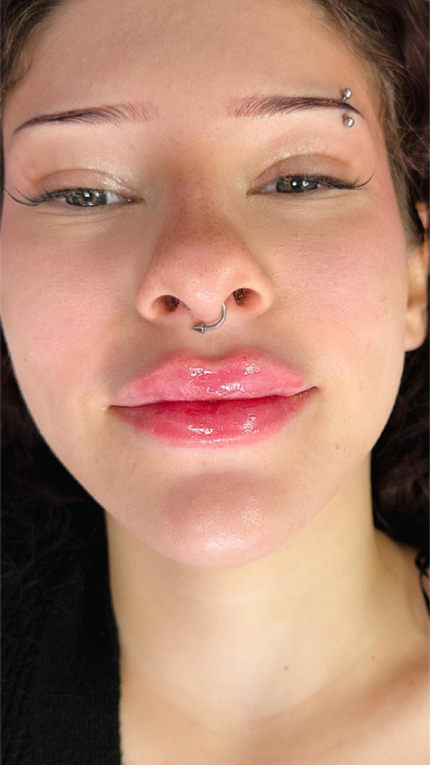 ✨Russian Lips 1ml✨
La méthode Russian Lips permet de redéfinir le contour des lèvres tout en apportant du volume de manière subtile et équilibrée.
Grâce à une injection précise et maîtrisée, le résultat est naturel, raffiné et parfaitement adapté à la morphologie du visage.
Un rendu lifté, sans effet “lèvres projetées”.
Pour un sourire sublimé en toute élégance.
Consultation sur rendez-vous.
#RussianLips #MédecineEsthétique #LèvresNaturelles
#InjectionHyaluronique #EsthétiqueProfessionnelle
#HarmonieDuVisage