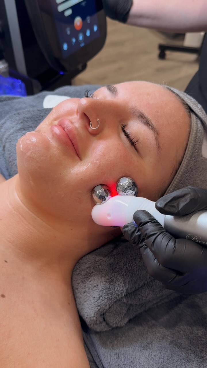 Give You’re Clients the Ultimate Bespoke Facial Experience 💦
Our Nova Hydra facial combines multiple advanced technologies in one luxurious, non-invasive treatment, delivering immediate, visible results for radiant, healthy skin.
🔷Scrape
Harnessing the power of high-frequency vibration waves, this step gently removes dead skin cells, blackheads, and excess keratinocytes.
🔷Miro Lift
Using state of the art micro current technology, this treatment reduces fine lines and wrinkles, firms facial contours, improves muscle tone, and minimises puffiness.
🔷Radio Frequency
A trusted, proven technology for skin tightening and anti aging. By stimulating fibroblasts through thermolysis, this treatment boosts collagen and elastin production, resulting in firmer, plumper, more youthful skin.
🔷Hydra Peel
Featuring vortex technology, working like a vaccum to deeply cleanse, exfoliate, and hydrate the skin while infusing it with nourishing serums.
Get in touch with our team and find out about payment options.
🌐www.novapellisaesthetics.com
💌info@novapellisaesthetics.com
📱0800 009 6397
📱WhatsApp 07497 831533
#novahydra #facialmassage #bespokefacial #radiofrequênciafacial #skintightening #glowingskin #clinicowners #salonowners #novapellis #training #skinhealth #consumables #noninvasive #instbeauty #professionalbesuty #collagenboost #beautyboost