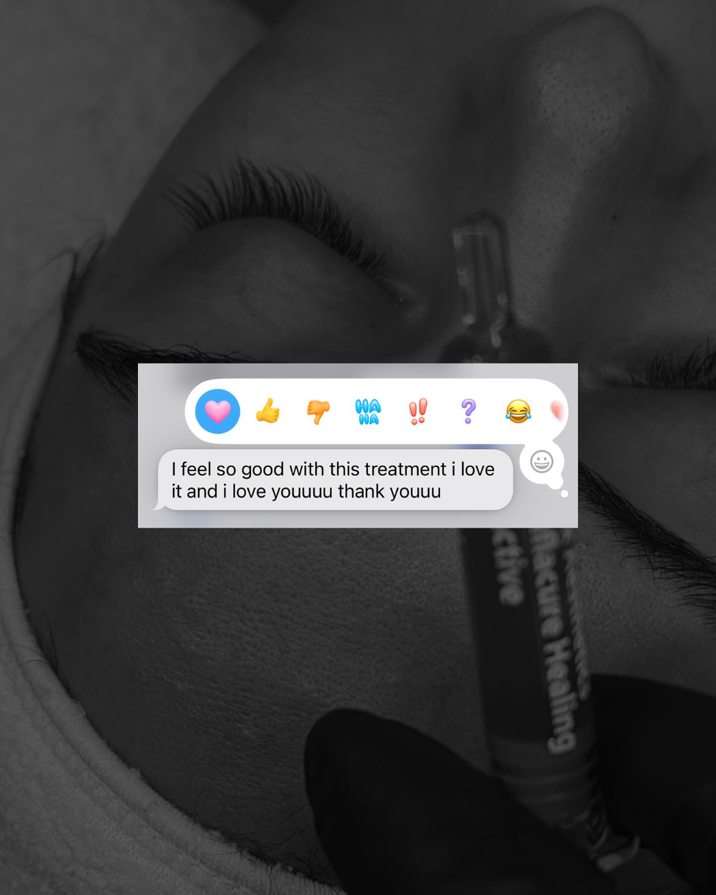 I pride myself on working ETHICALLY.
The effect? Full trust from my clients. I will always recommend what is best for my client and their skin, and I will always do it honestly, all expectations/ possibilities disclosed.
Client specific Skin- care guidance 🤍 Working for YOU & YOUR skin. xoxoxo your esthi!
Ready to elevate your skin’s healing? BOOK NOW.
#browardesthi #christianbusiness #christianskincare #christianentrepreneurs #browardacneclinic #browardfacials #browardfacialist #browardskincare #browardacnetreatement #browardacnespecialist #miamifacials #miamiesthetician #browardacneclinic #esthiebestie