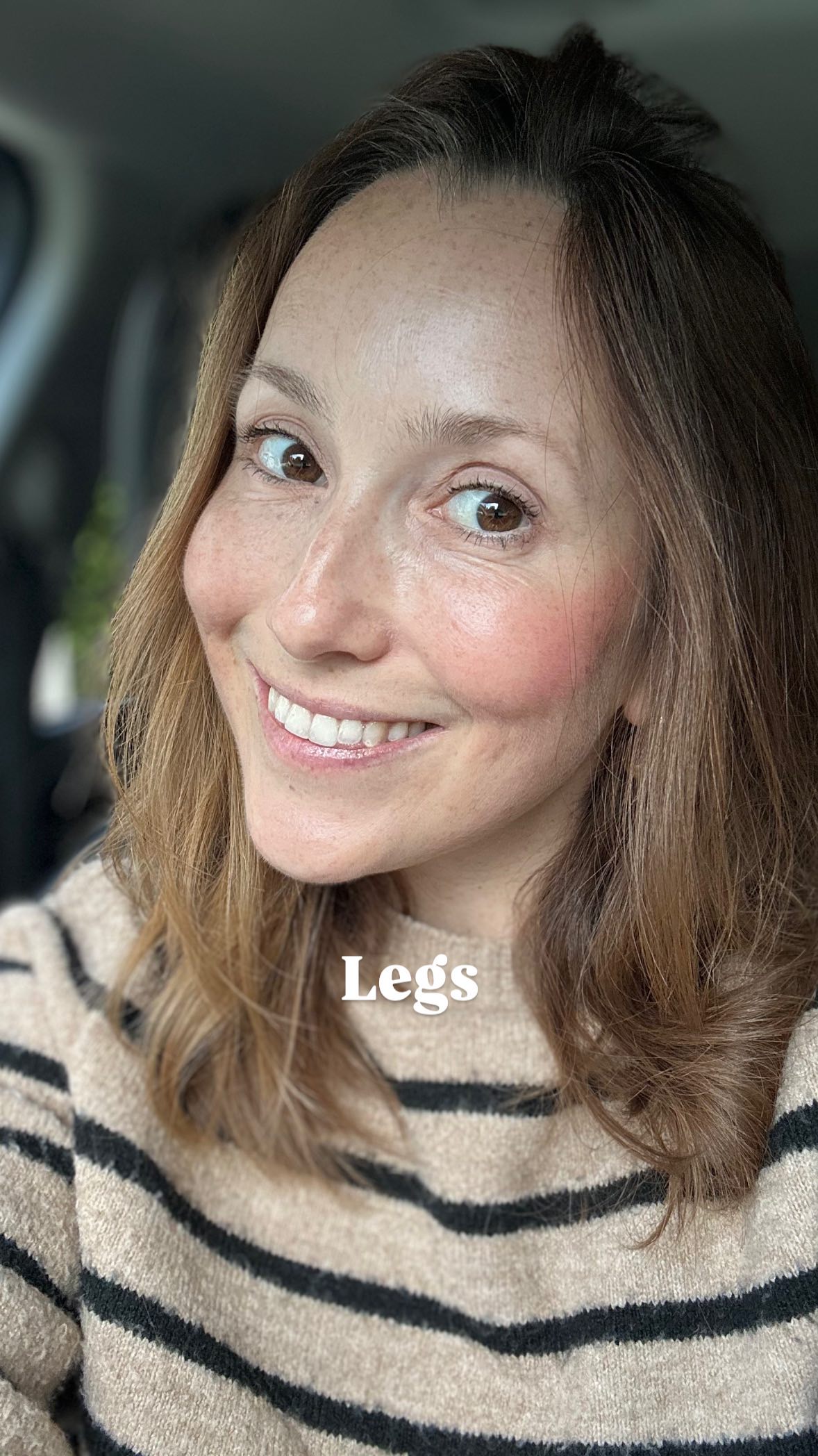 Enjoy the sun! ☀️
Nobody cares how pale your legs are. Wear that cute dress and get em out! 💃🏻
#personalstylist #springstyle2025 #summerstyle2025