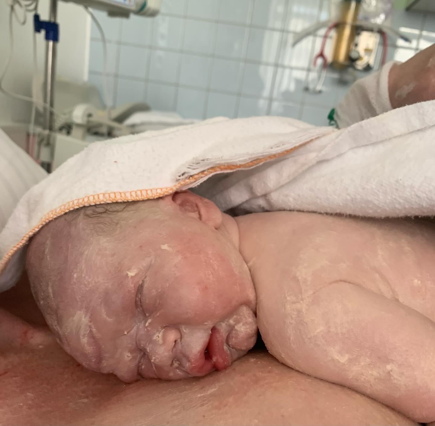 ✨Vernix✨
That creamy, white coating on your newborn’s skin? It’s called vernix—and it’s pure magic.
Rich in protective proteins and moisturizing fats, vernix acts as a natural barrier, keeping baby’s skin soft, hydrated, and safe from infection.
Delaying baby’s first bath gives the vernix time to absorb - supporting baby’s skin, immunity, and transition to life outside the womb💛
#Vernix #DelayedBathing #NewbornCare #NaturalProtection #fairfaxdoula #loudoundoula #doulatips #informedbirth