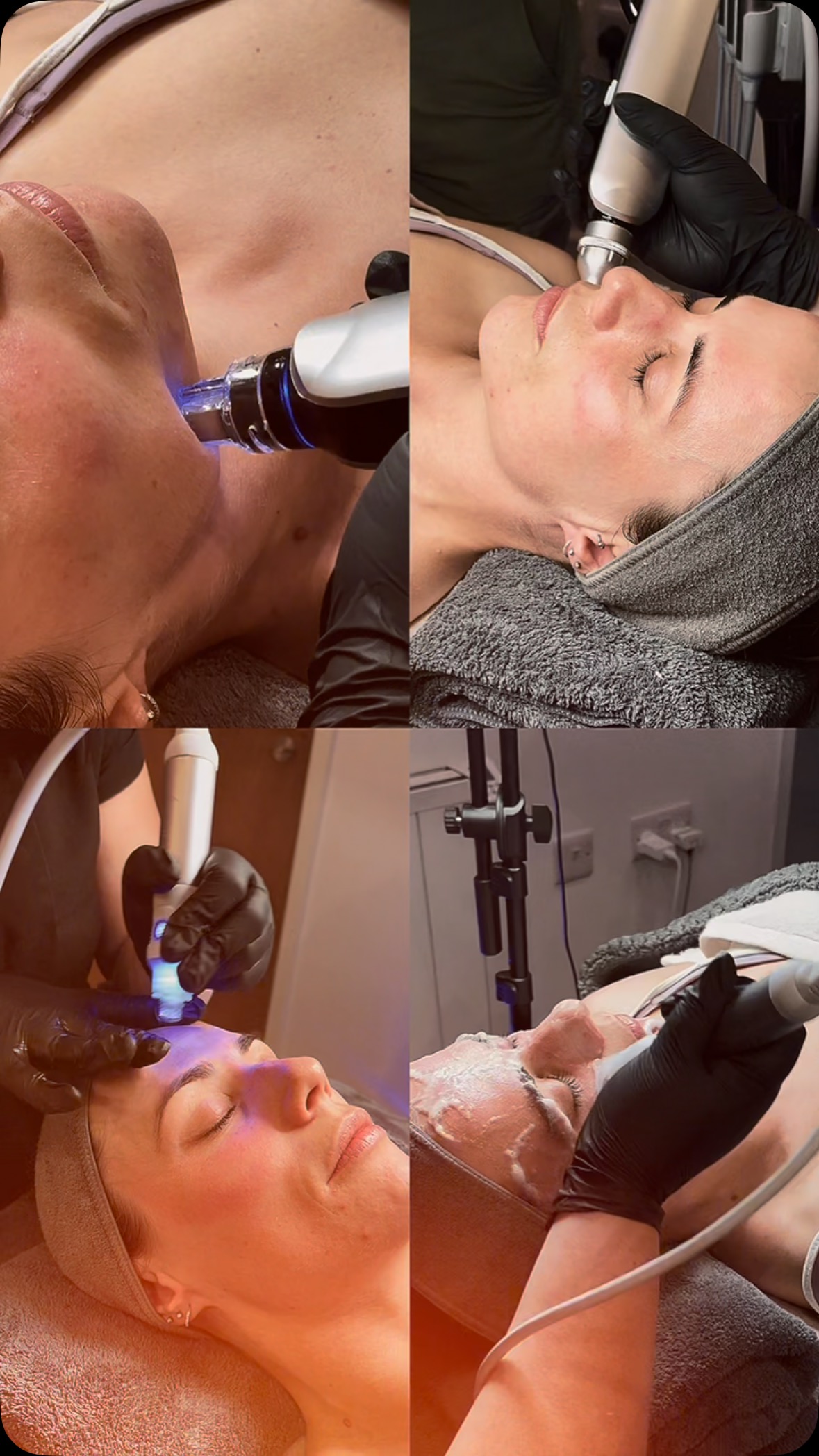 Time to Give Your skin a Spring Clean!
Say hello to fresh, radiant skin with the Nova Hydra Facial - the ultimate treatment experience for all skin types, including sensitive skin.
The next-generation facial combines 10 advanced technologies in one powerful treatment, offering everything from skin Tightening and exfoliation to oxygenation, Mesotherapy, and more.
✨Why Nova Hydra?
Suitable for all skin types.
Exceptionally customisable to suit individual skin concerns.
Gently treats sensitive skin while delivering, visible, glowing results.
The perfect spring reset for your skin.
Get in touch with our team to find out more.
🌐www.novapellisaesthetics.com
📩info@novapellisaesthetics.com
📱0800 009 6397
📱WhatsApp 07497 831533
#novahydra #facialmassage #glowingskin #salonowners #clinicowners #training #skinhealth #radiofrequency #mesotherapy #exfoliation #cleanskin