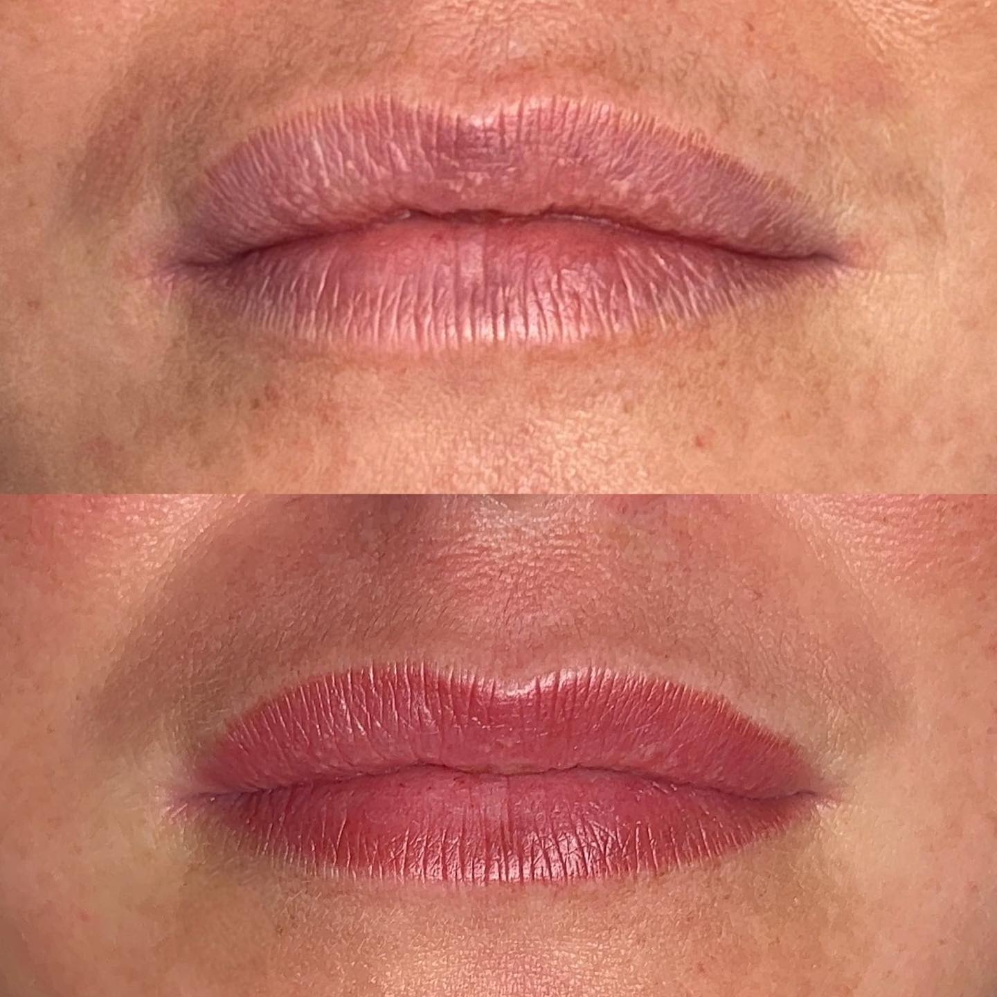 Yours just better ♥️ lip tint - healed after one session. How much healthier do these lips look 👏🏼