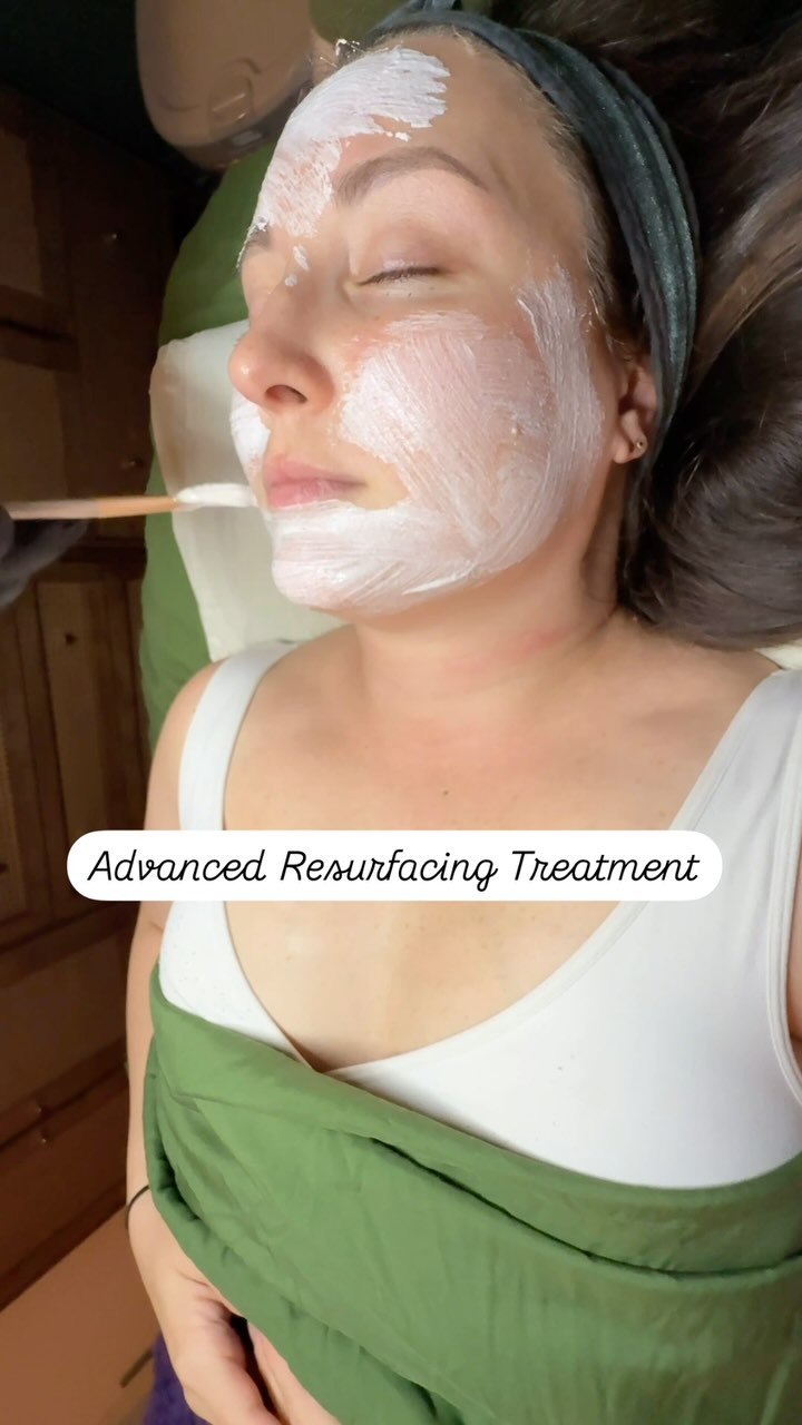 If your goal is to have flawless, glass-skin, then you must try our Advanced Resurfacing Treatment✨
Also a perfect Mother’s Day gift, this treatment allows for exfoliation and hydration, as well as dermaplaning and LED therapy to help with cell turnover and boosting collagen production.
Call or DM us to schedule an appointment or to purchase a gift card.
#kensingtonmd #thecosmeticworkshop #kensingtonmdfacial