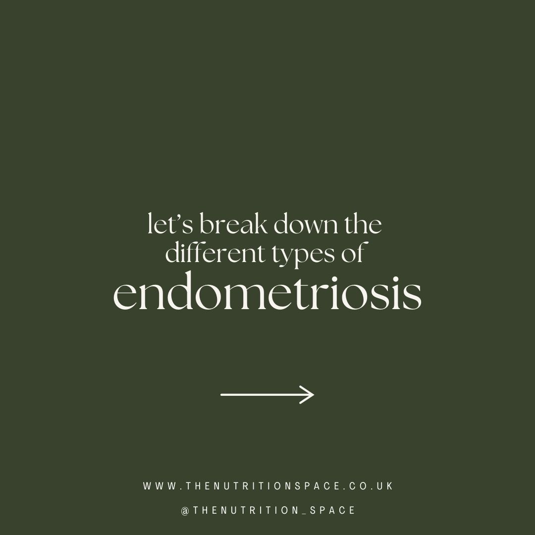 There are several forms of endometriosis, each presenting differently in the body:
🔹 Superficial Peritoneal Endometriosis - affects the surface of the peritoneum (the lining of the pelvic cavity).
🔹 Ovarian Endometriomas - cysts (chocolate cysts) filled with old blood on the ovaries.
🔹 Deep Infiltrating Endometriosis - lesions that grow deep into pelvic structures like the bowel, bladder, and ligaments.
🔹 Extragenital / Extrapelvic Endometriosis - where tissue grows outside the pelvic region, such as the diaphragm or lungs.
🔹 Adhesions and Scar Tissue - a complication where organs stick together due to inflammation.
It’s important to know:
You can have one or multiple types at the same time.
The type or stage of endometriosis doesn’t always match the level of pain or impact on fertility - some with minimal lesions experience intense symptoms, while others with extensive disease may have little discomfort.
Each experience with endometriosis is deeply personal and unique.
Because of its complexity, true support means addressing the individual - not just the diagnosis. This is why in nutritional therapy, the approach is tailored to your symptoms, your challenges, and your goals.
Your story matters just as much as your diagnosis.
#endometriosis #endometriosisawareness #endometriosissupport #endometriosiseducation #womenshealth #hormonehealth #nutritionaltherapy #endoawareness #chronicillness #guthealth #healyourbody #integrativehealth