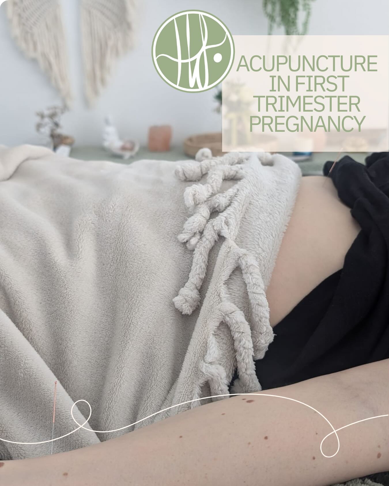 Acupuncture is safe in first trimester pregnancy and I encourage my clients to continue treatment until safely in the second trimester.
Today I’ve had two pregnant clients both in the first trimester and both experiencing fatigue and nausea.
Whilst their symptoms are similar their chinese medicine diagnosis sets apart tiny clues using their unique signs, symptoms, tongue and pulse diagnosis.
#PregnancySupport #FirstTrimesterCare
#PregnancyJourney #AcupunctureForPregnancy
#NaturalPregnancySupport #pregnancyNauseaRelief #PregnancyFatigue #PregnancyAcupuncture