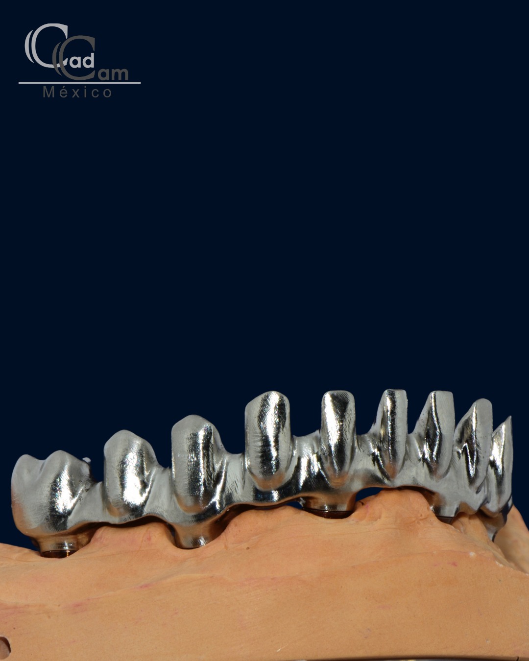 Una rehabilitación completa en arco superior lograda al 100% en flujo digital #coronas #carillas #model #smile #sonrisa #cadcam
