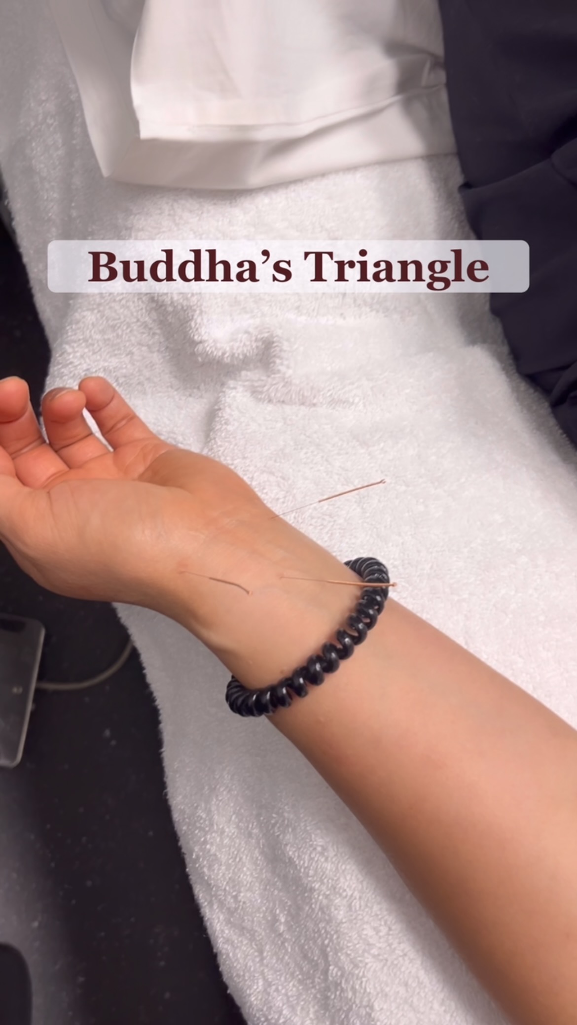 Buddha’s Triangle ✨
A clinical favourite for calming the nervous system and supporting emotional regulation.
🫁 LU9 – anchors the breath, supports Lung Qi, and helps release grief
🫀 HT7 – nourishes Heart Blood, calms the Shen, and reduces anxiety
🧠 PC6 – regulates the Heart, eases chest tightness & palpitations, and soothes emotional tension
This triangle connects Lung, Heart, and Pericardium to harmonise your emotional centre and regulate your nervous system.
DM me “calm” to learn how acupuncture and TCM can support your nervous system and emotional health.
#acupuncture #acupuncturepoints #tcm #chinesemedicine #holistichealth #nervoussystemsupport #stressrelief #emotionalhealing #anxietyrelief #acupunctureforanxiety #shen #hearthealth #lungqi #mindbodyconnection #naturalhealing