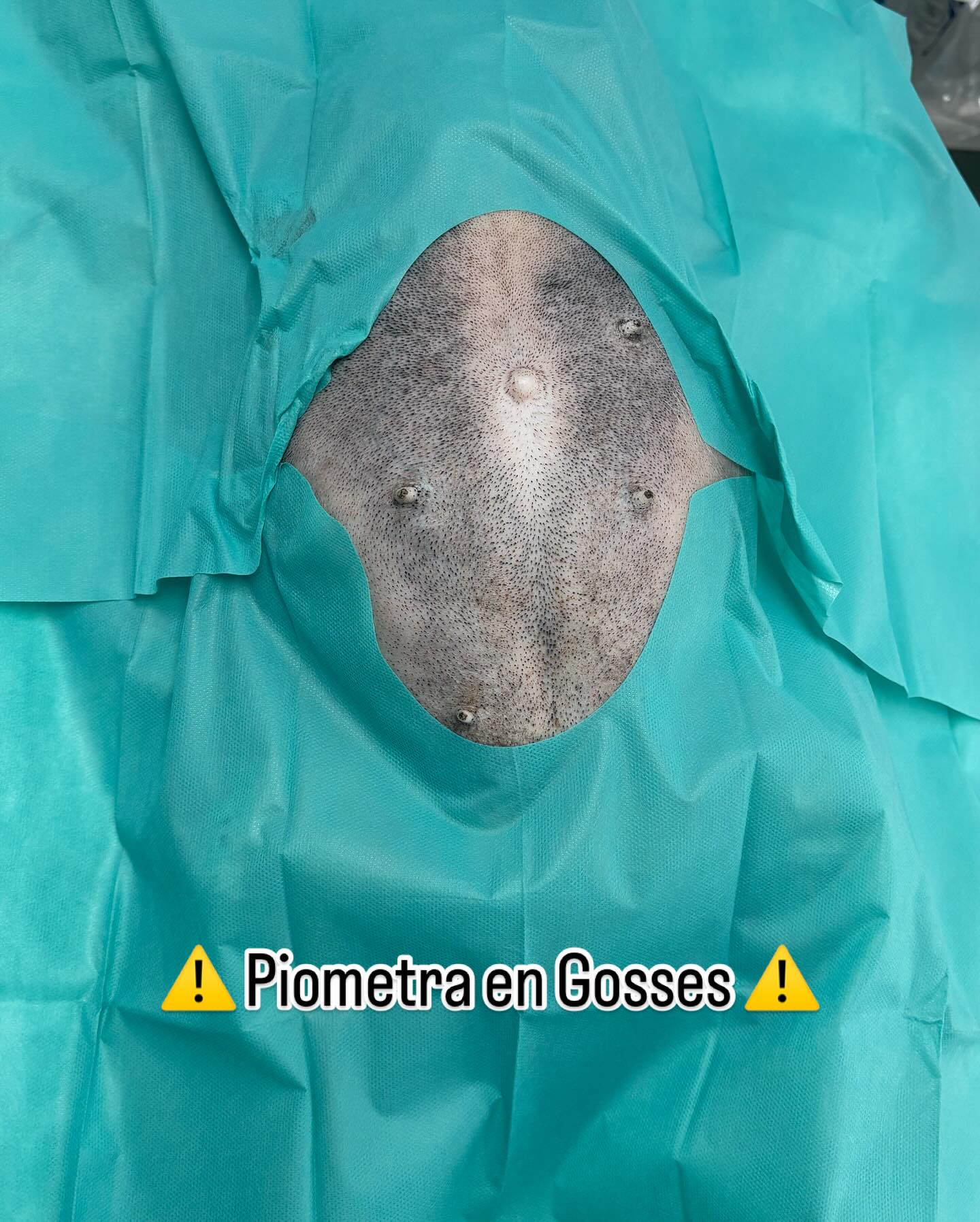 CONTINGUT SENSIBLE ⚠️
⚠️La piòmetra pot posar en perill la vida de la teva gossa.⚠️
Es tracta d’una infecció greu de l’úter, molt comuna en gosses no esterilitzades, especialment a partir dels 6-7 anys. Pot aparèixer dies o setmanes després del zel i pot evolucionar ràpidament.💉🐶
Símptomes comuns:
• Decaïment
• Vòmits o diarrea
• Augment de la set i de la micció
• Secreció vaginal amb pus
• Abdomen inflat
És una urgència veterinària. ⚠️El tractament habitual és la cirurgia per extreure l’úter infectat.
La millor prevenció? Esterilitzar-la abans que aparegui el problema.