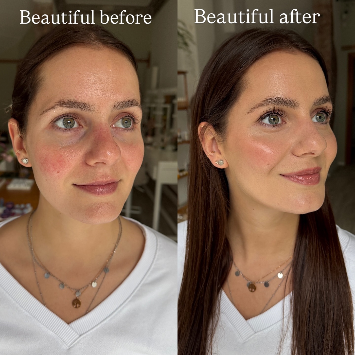 Glowing Skin und einen Natural Look für Corinna ✨🤍!
Wie immer gilt: Beautiful Before- Beautiful After.🩷
Heute mit dem Thema Rosacea und Rötungen. Corinnas Wunsch war ein frischer, natürlicher, ausgeglichener und strahlender Look und eine Hautpflege, die sich beruhigend und endlich stimmig für ihre super empfindliche Haut anfühlt.
Ich habe immer mehr Kundinnen mit Rosacea (in verschiedenen Ausprägungen) oder auch anderen Hautthemen (Neurodermitis, Allergien, Entzündungen). Auch hier gibt es tolle Produkte im Naturkosmetik-Bereich! Allerdings kommt es auf ein paar sehr wichtige Punkte an, wie beispielsweise dass die Produkte keinen Alkohol enthalten oder keine Duftstoffe / ätherische Öle. Mittlerweile gibt es hier eine super Auswahl.
Die Hautpflege sollte gerade bei Rosacea super sanft, Feuchtigkeitsspendend und leicht sein, nicht zu ölig oder zu gehaltvoll. Oben habe ich euch nochmal ein paar Punkte zum Makeup zusammen gefasst. (Heute also der äußere Teil, passend zum Live am Dienstag für den inneren Teil bei Hautproblemen, schaut euch das gerne nochmal an). 🩷
Und: ich würde gerne mehr Reels mit echten Kundinnen euch zeigen, so dass ihr mehr teilnehmen und euch auch wiederfinden könnt. Dazu bald mehr ☺️🫶🏻✨
Wenn ihr euch hier etwas wünschen könntet- was würdet ihr gerne sehen? Und inwieweit betrifft euch vielleicht das Thema empfindliche Haut, Rötungen, Entzündungen? 🤍
Lisa ✨