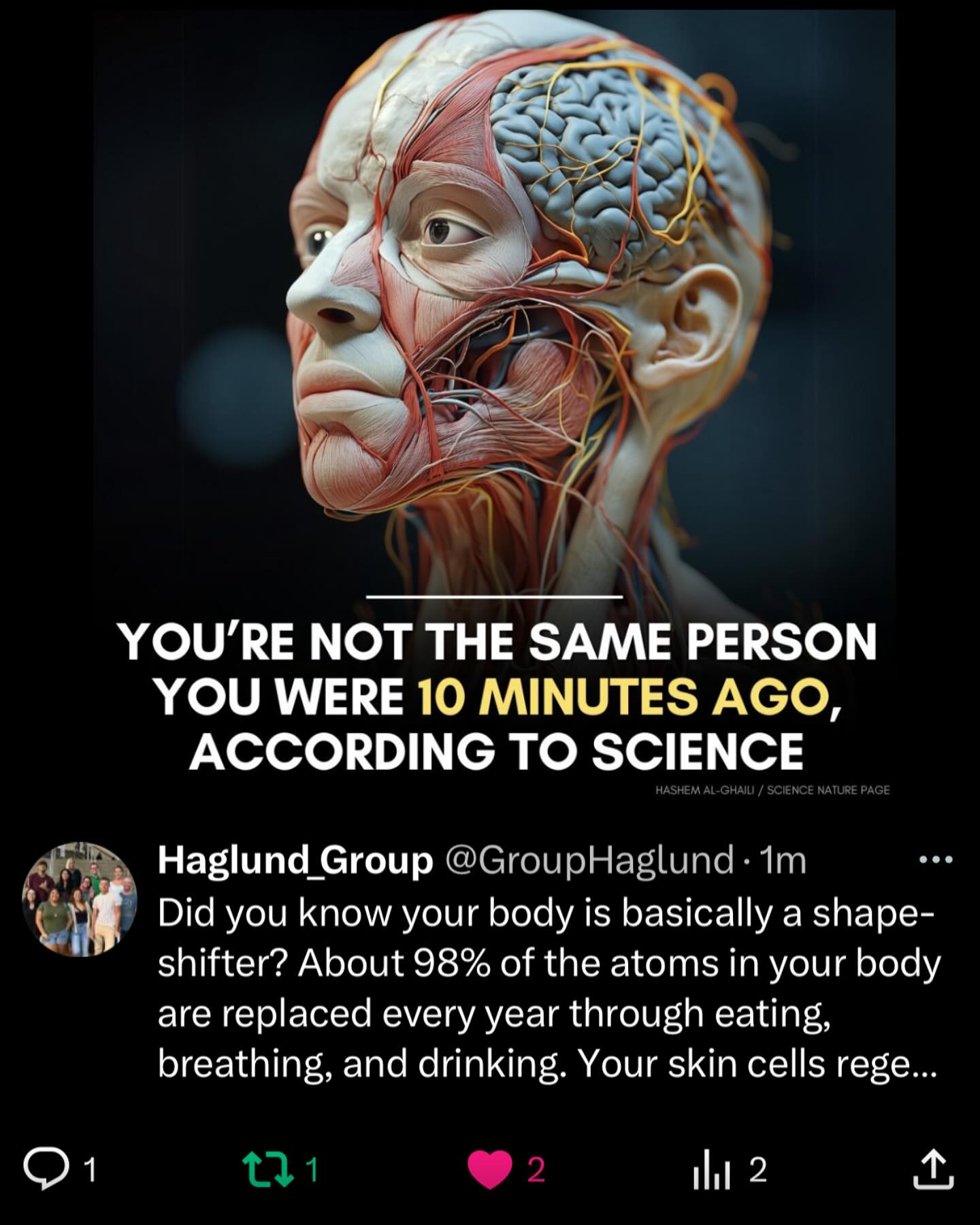 Did you know your body is basically a shape-shifter? About 98% of the atoms in your body are replaced every year through eating, breathing, and drinking. Your skin cells regenerate every 2–4 weeks, your stomach lining renews every 5 days, and even your bones remodel over the course of a decade. So while you may feel like the same person, you’re physically made of almost entirely new material each year—a walking, talking, regenerating miracle!
Reference:
https://www.snopes.com/fact-check/does-body-replace-itself-seven-years/
https://www.discovery.com/science/Body-Really-Replace-Itself-Every-7-Years
#humanbody #regeberation #funfacts #funfactfriday #funfact #scientificfacts #hawaii #universityofhawaiiatmanoa #uhm #universityofhawaiia #uh #science #DNA #chromosomes #researchgroup #haglundgroup #drhaglund