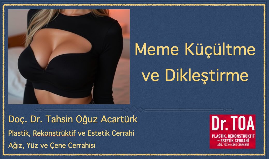 Meme Küçültme………Meme Estetiği ….. Kaldırma Dikleştirme Küçültme....
Doçent Dr. TAHSİN OĞUZ ACARTÜRK
#i̇zmir #izmirestetik #marmarisestetikcerrahi
#muğlaestetikcerrahi #marmarisestetik #memeestetiği #memebüyütme #memedikleştirme #memeküçültme #jinekomasti #rinoplasti #estetikburun #burunestetiği #burunameliyatı #lenfödem #lipödem #fethiye #mikrocerrahi #yüzgerme #karıngerme #gözkapağı #gözkapağıestetiği #blefaroplasti #estetikcerrahi #aydın #gözkapağıameliyatı #marmaris #bodrum #datça #@marmaris.estetik.cerrahi