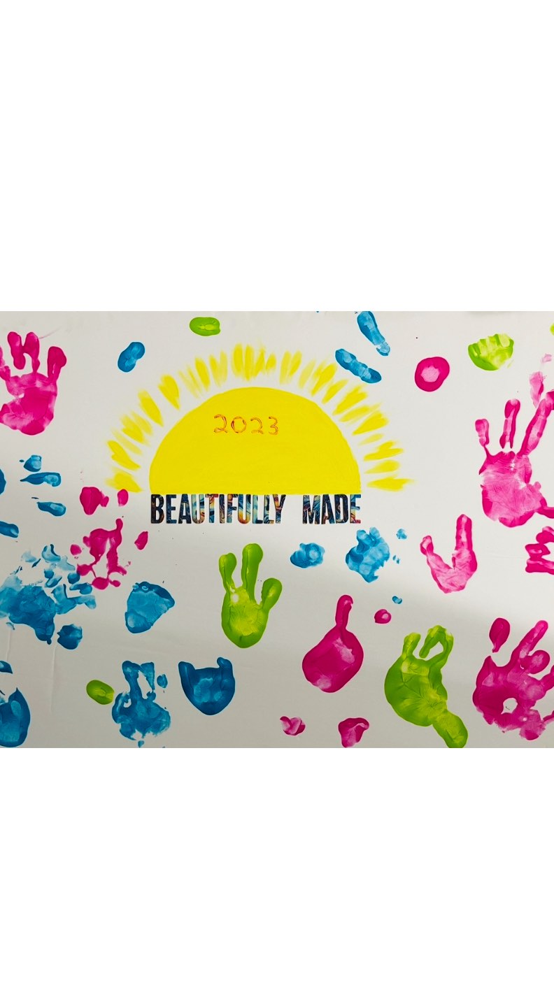 Nearing our 4th annual Limb Difference Event with the Hand and Orthopedic Upper Extremity Program at @bostonchildrens -June 14th!!
Each year has been so special. We’re thankful to all of the families, donors, volunteers, organizations, physicians and the @thecouldregistry for making this all possible.
Getting excited to see everyone next month!!! :)
✨it’s not too late to RSVP!! 🥳
✨if you’d like your resources shared please DM me ASAP!!
Special thanks to: @campnolimits @grip_uf @nubabilityathletics @ontheotherhandtherapy @eazyhold @acorn_cottage_press @adventuresofroxyroo @mimitens @babyzips.ca
For attending/sharing resources at our past events 🙏
.
.
#bostonchildrenshospital #boston #orthopedic #beautifullymade #limbdifference #limbdifferenceawareness #beautifullymadecommunity #resources #community #support #inclusion #inclusiveeducation #educate #diversity #beautiful #collaboration