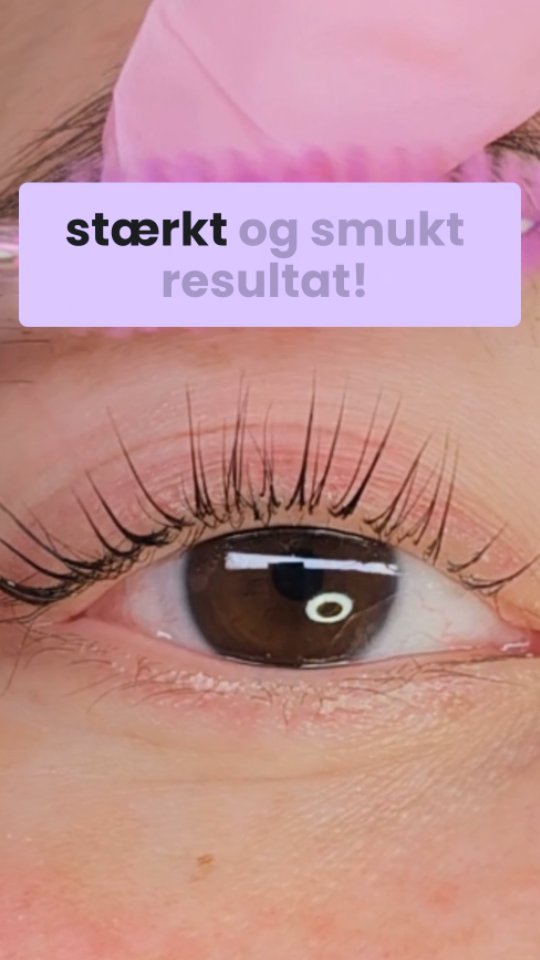 Undgå ujævne resultater i dit lash lift
Husk altid at fjerne overskydende lim, når du arbejder med Perfect Glue Balm ✨ Hvis der ligger for meget lim ovenpå hårene, kan væskerne ikke trænge ordentligt igennem – og det kan betyde, at lash liftet ikke bliver jævnt ❌
Når limen påføres korrekt og i et tyndt lag, får du et ensartet og smukt resultat – hver gang!
#LashLiftTips #PerfectGlueBalm #LashArtist #LashLiftResultater #LashLiftProTips