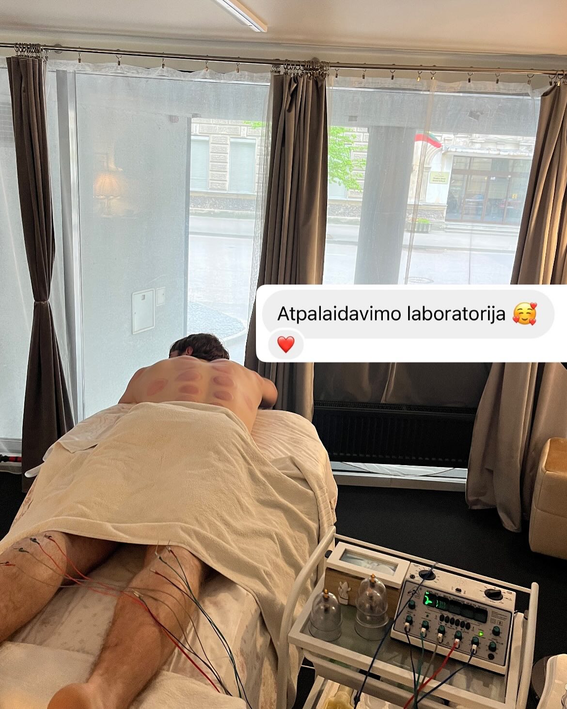 #akupunktura #acupuncture #sveikata #healthy #healing