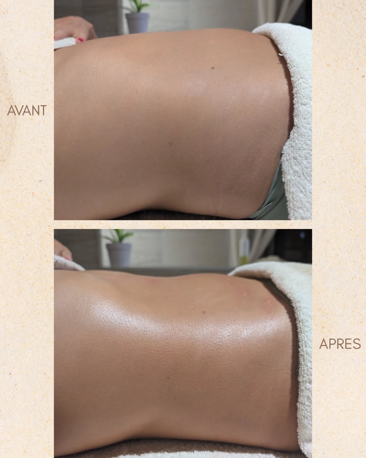 | DRAIN & SCULPT |
Un beau résultat après une séance où on a combiné drainage corps entier et madérothérapie au niveau du ventre🍃
Merci à ma cliente pour sa confiance. Elle est dans son 6eme mois post partum, alimentation et activité sportive, déterminée à prendre soin de son mental et célébrer son corps 👏🏼✨
Vous accompagner, un vrai bonheur ☀️
Toi aussi, n'hésites pas à me contacter en DM et je te conseillerai en fonction de tes besoins 🌿