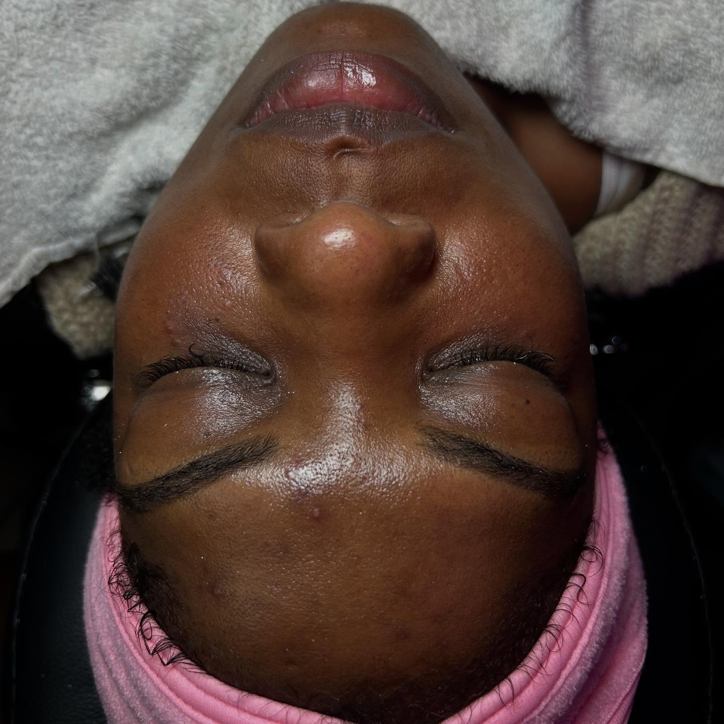 Dermaplaning is a skin treatment that uses an exfoliating blade to skim dead skin cells and hair from your face.Dermaplaning aims to make your skin’s surface smooth, youthful, and radiant. This treatment can aim to remove deep scarring from acne and uneven skin tone on your skin. It’s also used to remove “peach fuzz,” the short, soft hairs on your face.
Benefits Of Facials
* Reduce Stress And Relieve Psychological Distress.
* Cleanse Your Skin.
* Prevent Aging. ...
* Facial Massage Promotes Blood Circulation. ...
* Rejuvenate Your Skin. ...
* Facials Help Detoxify The Skin. ...
* Treat Acne And Acne Marks. ...
* Eliminate Whiteheads And Blackheads.
Follow my business page @_FacingIt & check out some of my work
Website: AubriaFacingIT.com
Are You FacingIT
#facials #bodysculpting #skintightening #collegeparkga #atlanta #eastpointga #skincare #bodygoals #cavitation #foryoupage #liposuction #lipo #facingit #atl #cellulite #bodyenhancement #atlantafacials #woodtherapy #facialsatlanta #radiofrequency #facialatlanta #skincareproducts #nonsurgical #vacuumtherapy #bodybutter #cellulitetreatment #explorepage #oils #cardib #bodycontouringatlanta