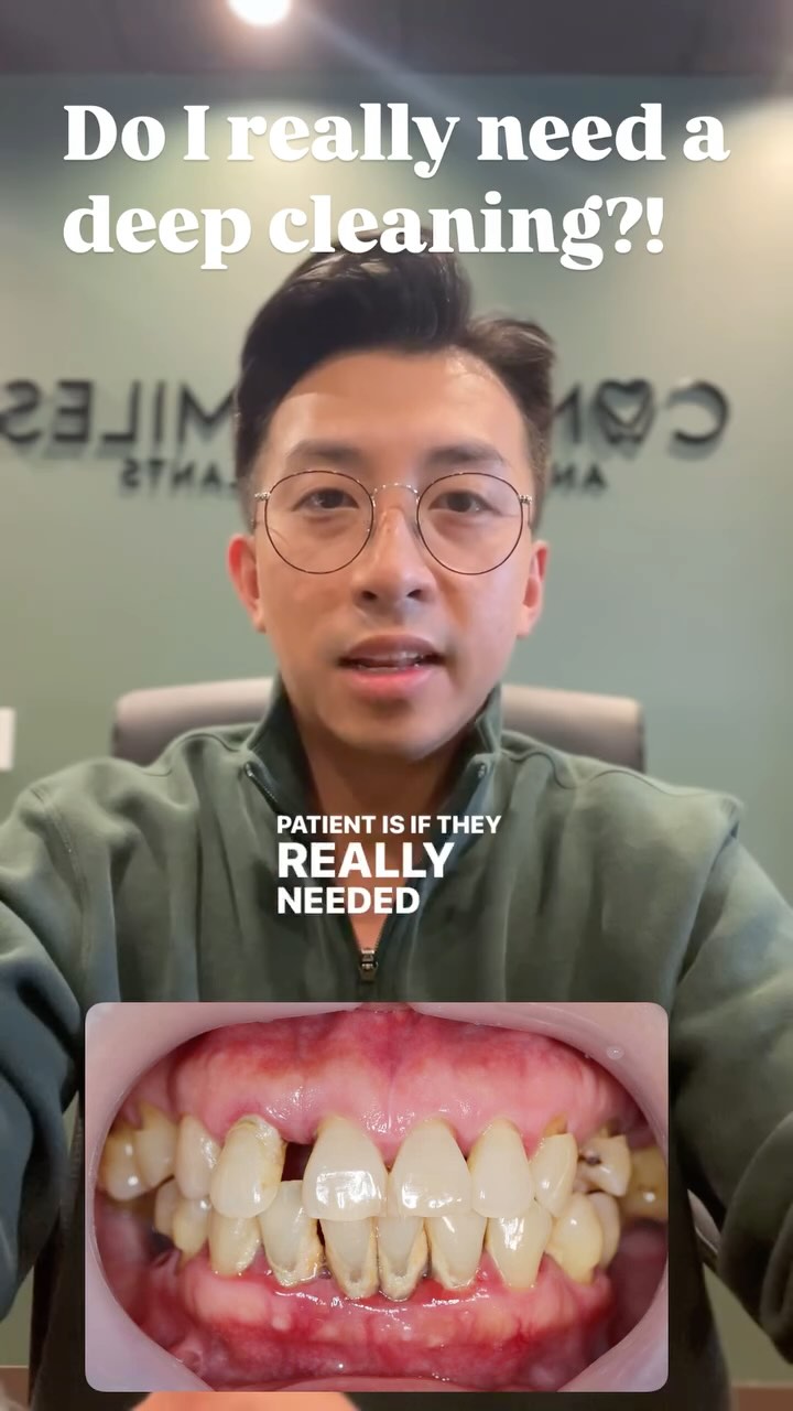 Your dentist says you need a deep cleaning. It’s important to ask the right questions. Let’s separate plaque from fiction!
#orlandodentist #deepcleaning #srp #scalingandrootplaning