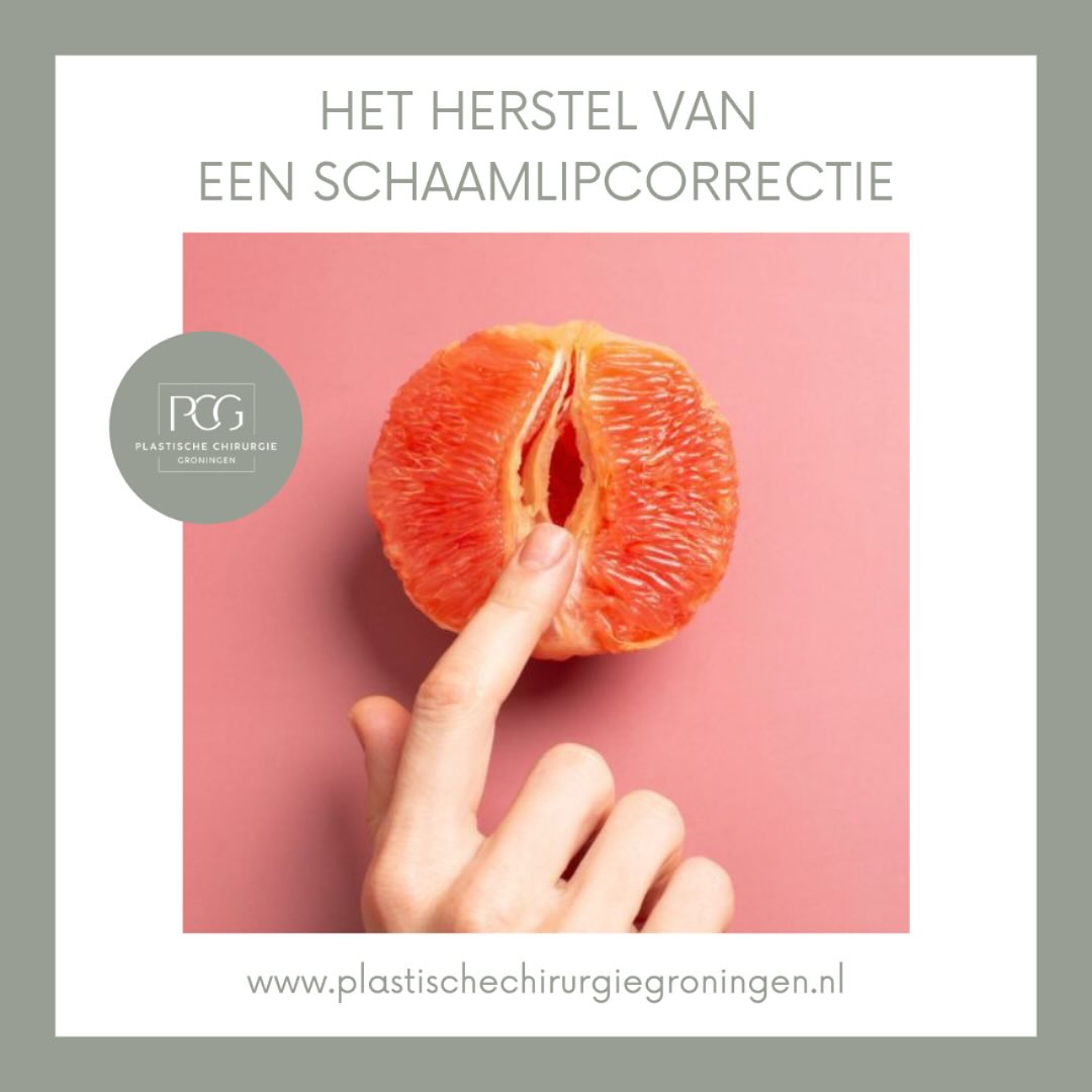 Een labiacorrectie is één stap – maar wat gebeurt er daarna? 💬 In onze nieuwste blog ontdek je alles over het herstel, de nazorg en wat je écht kunt verwachten. 📖✨
👉 Lees de blog nu via de link in onze story!