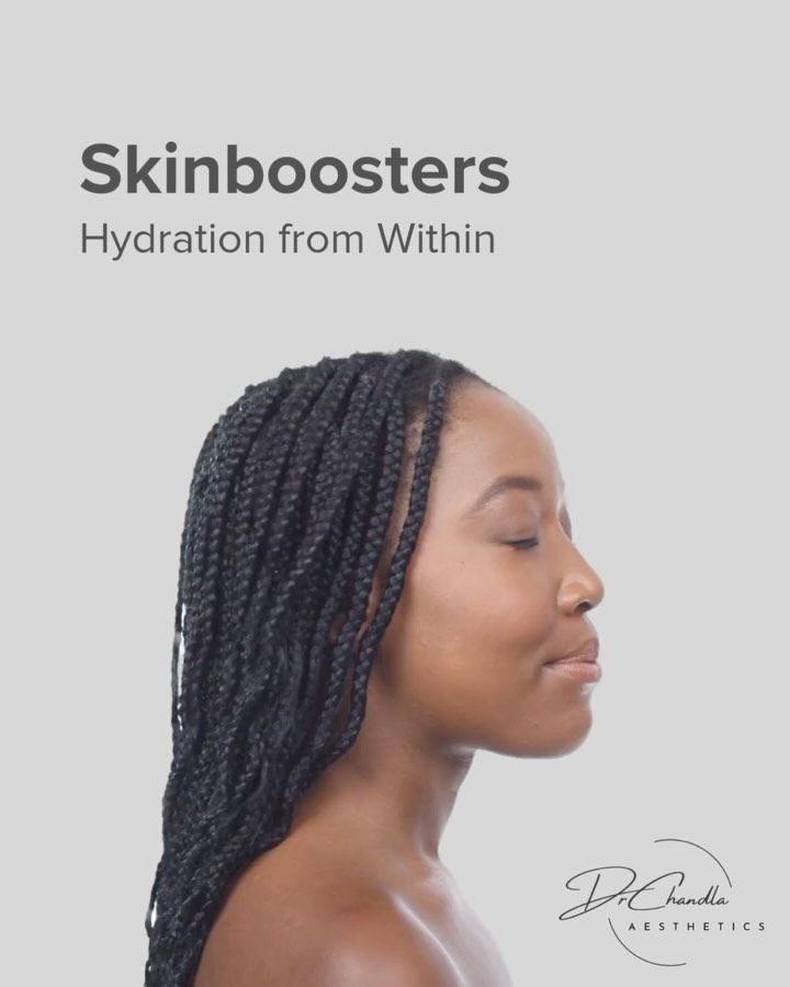Is your skin ready for the summer? Ever wondered how to achieve that ‘lit-from-within’ glow?
Skin boosters are your answer!
Skinboosters (also called injectable moisturisers) are injectable skin treatments which produce a refreshed, plumped yet natural and ‘not done’ look.
Products like Profhilo®, Redensity, Sunekos, Hydrobooster
and Belotero Revive are not used to change the shape of your face, but are an excellent choice if you want to improve skin texture and deliver a huge dose of long-lasting hydration.
As we age, particularly after 30, the amount of collagen, fat and elastin in the skin decreases markedly. The result is a loss of volume, the appearance of fine lines and a general dulling of the skin. Skinboosters treatments are the perfect rejuvenating treatment to combat these signs of skin ageing, hydrating the skin subdermally and improving its overall health.
Primarily, they are used to treat the face, but it can also be used to rejuvenate the neck, décolletage, hands, arms and even knees!
Book your FREE consultation to find out more!
Dr Chandla Aesthetics is a Doctor Led Medical Aesthetics Clinic.
WhatsApp: 07930674092
Email: info@drchandlaaesthetics.co.uk
www.drchandlaaesthetics.co.uk
#SkinBoosters #Hydration #GlowFromWithin #AestheticTreatments #SkincareScience #AntiAgeing #HydratedSkin #YouthfulSkin #skinboosters #profhilo #redensity #hydrobooster #beloterorevive #sunekos