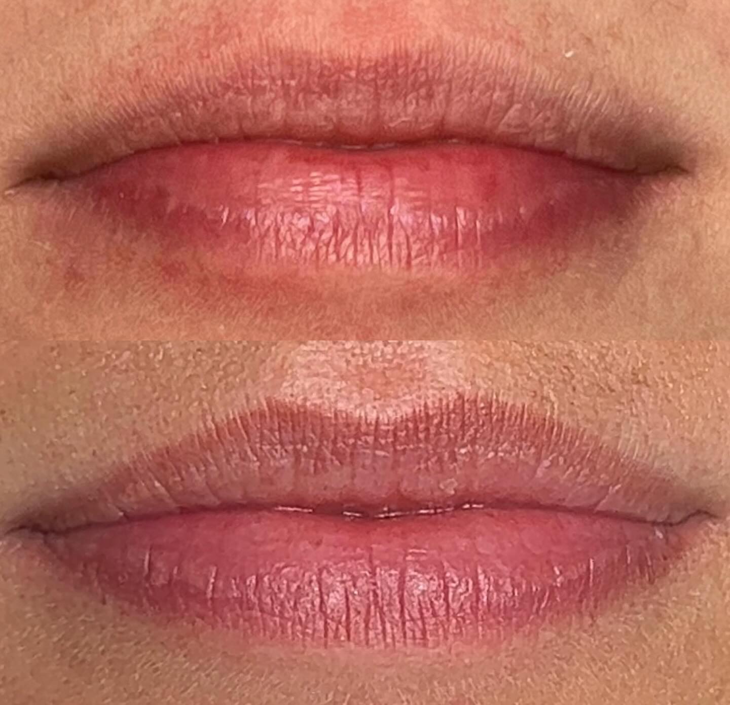 NATURAL LIPS ♥️ if natural is your vibe 🙌🏻 Yours just better 🤤A small amount of colour added to just fill in those pale areas and bring the colouring into the rest of the lip. Love ! Natural fullness 🥰