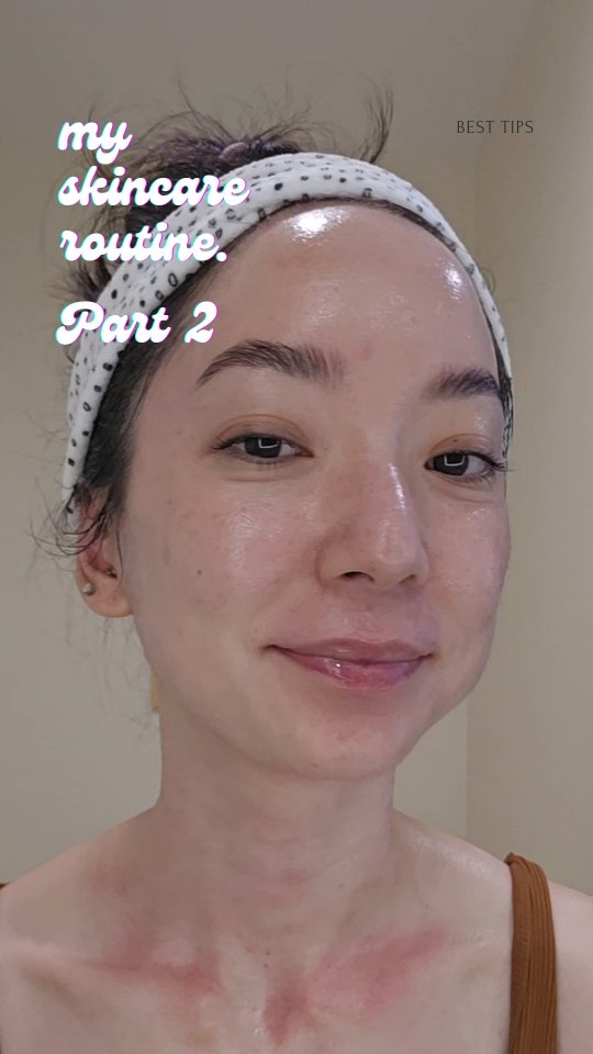 ✨ Consistency > One-off treatments ✨
A single facial or peel once a month can only take your skin so far—real, lasting change comes from what you apply every day.
Professional guidance + medical-grade skincare is designed to work with your skin at the cellular level, supporting barrier repair, renewal, and long-term resilience.
Think of it like brushing your teeth: you wouldn’t go to the dentist once a month and skip your daily care, right? 🧴🧖♀️
🗓️ Daily commitment = visible, lasting results.
Because healthy, glowing skin is built day by day.
📲 Ready to get serious about your skin?
Book your virtual skin consult today and get a personalized routine with medical-grade products tailored to your unique skin goals.
✨ Let’s build your daily glow strategy—one that actually works.
#VirtualSkinConsult #SkinGoals #AMBHGlow #GlowStrategy #ProfessionalSkincare #MedicalGradeSkincare #ConsistencyIsKey #SkinHealthMatters #ProfessionalSkincare #DailyGlow #BarrierSupport #AMBHGlow #SkinInvestment #ModernBeauty