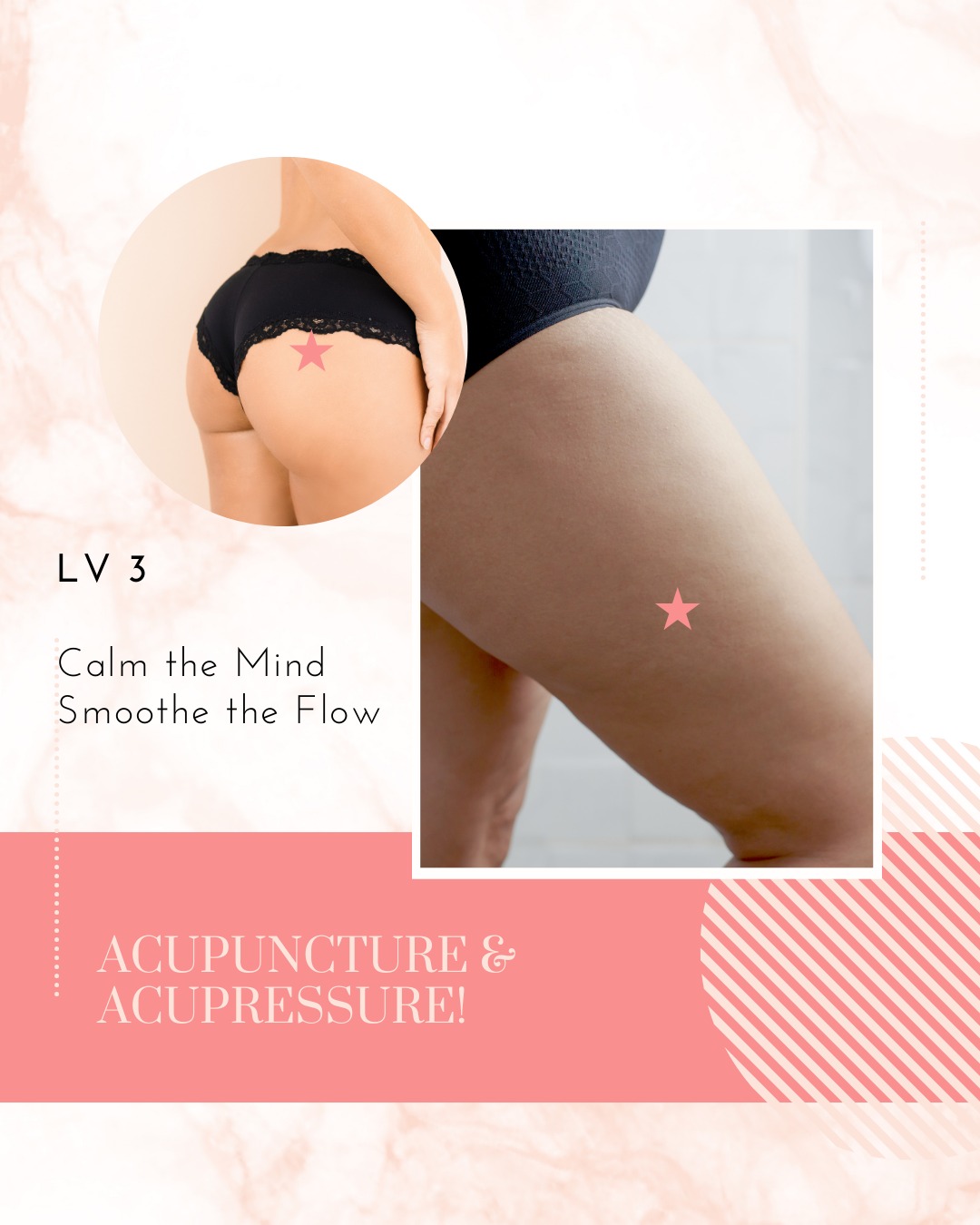 💪 Muscle Tension? Meet Gallbladder 30 & 31
In Traditional Chinese Medicine, the Gallbladder channel plays a big role in movement, flexibility, and muscular health—especially along the sides of the body and legs.
Two powerhouse points for releasing tension and restoring mobility are:
GB 30 (Huantiao) – Located deep in the gluteal area, this point is famous for:
✔ Sciatica & hip pain relief
✔ Releasing deep-seated muscle tension
✔ Improving leg circulation and mobility
GB 31 (Fengshi) – Found on the outer thigh, this point helps with:
✔ Tight IT bands or quads
✔ Numbness, tingling, or heaviness in the legs
✔ Tension from overuse or long sitting
These points are especially helpful when the Gallbladder meridian is congested, leading to stiffness, limited range of motion, or aching in the hips and legs.
Whether you're active, sitting all day, or feeling spring’s call to move, acupuncture and bodywork on GB 30 & 31 can help your muscles feel more open, strong, and supported.
#TCM #GallbladderMeridian #MuscleHealth #AcupuncturePoints #HipPainRelief #MobilitySupport #TraditionalChineseMedicine