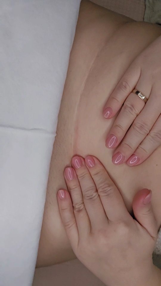 🩹 Why Scar Therapy After a C-Section Matters 🩹
Your C-section scar is more than skin deep — it’s a reminder of strength, but it can also cause discomfort if not properly cared for.
✨ Why It’s Important:
Scar tissue can bind layers of skin, muscle & fascia
This may lead to tightness, pain, or even back/pelvic issues
Emotionally, it can help reconnect with your body after birth
💆♀️ Benefits of Scar Therapy:
✅ Reduces tightness & restrictions
✅ Supports healthy tissue healing
✅ Improves appearance & mobility
✅ Enhances sensation and comfort
✅ Aids in emotional healing post-birth
🌿 Gentle, hands-on therapy helps your body heal from the inside out.
💬 Have questions or want to know if scar therapy is right for you? Send a DM — I’d love to help.
#CSectionRecovery #ScarTherapy #PostnatalHealing #WomensHealth #CSectionScar #BodyAfterBirth #PostpartumCare #HealingJourney #TatjanaSenkova #Newburyberkshire #mlduktherapists #restorescartherapypractitioner