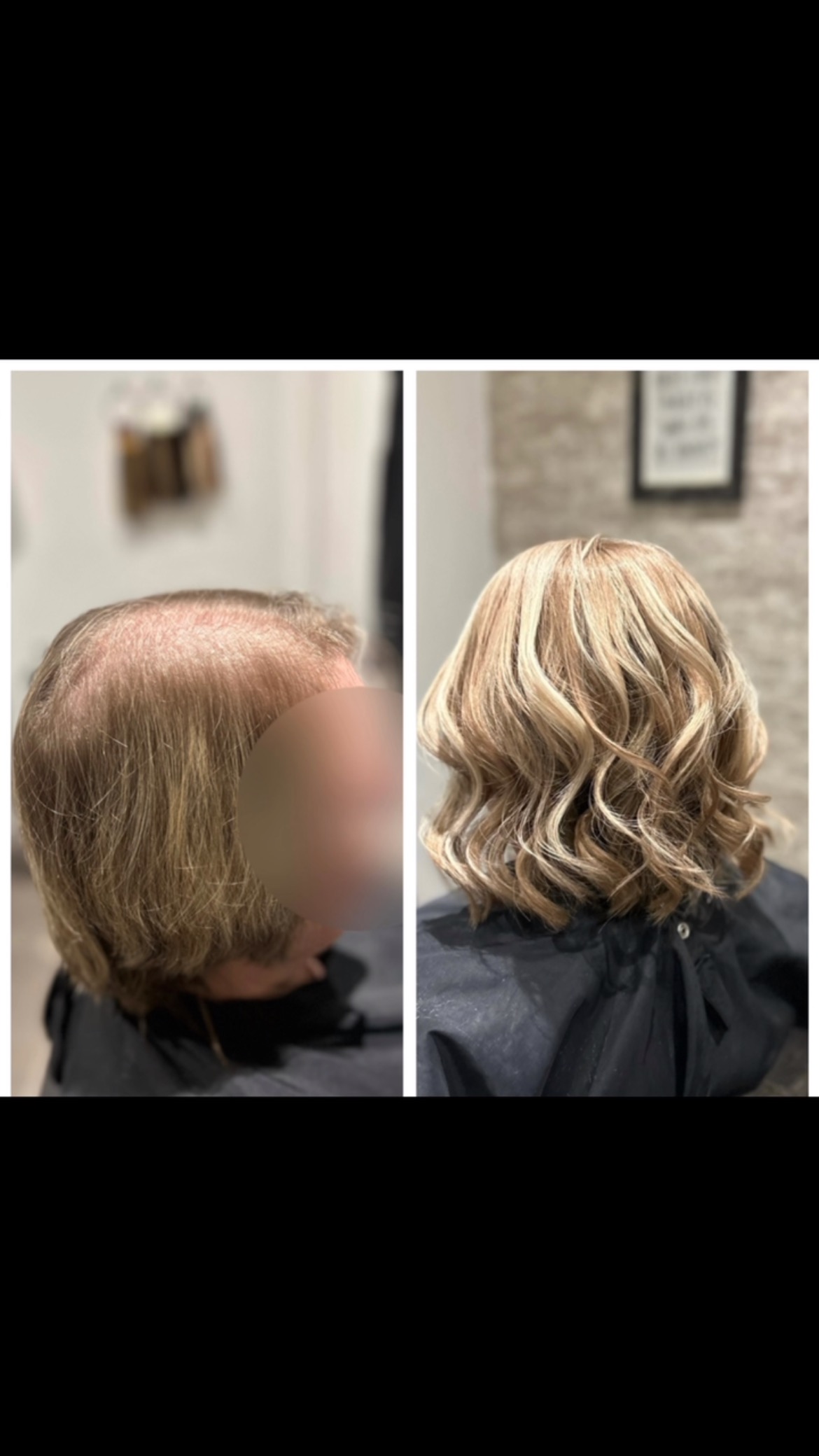 Before & After pics from recently built Hair Integration Systems 🤩
.
.
.
.
#lacetopwigs #lacefrontwigs #lacewigs #wigs #lacefrontal #alopecia #areata #hairloss #hairreplacements #bespokewigs #customcolouredwigs #handmadewigs #wigbuilding #hairintegration #laceintegration #hairextensions #weave #hairlossspecialist #trichologist #trichology #hairlosssolution #hairlosssalon #hair