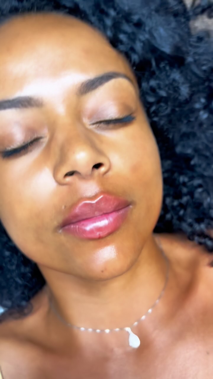 Amazing lips on a amazing woman by Dr Carlier ☺️💋