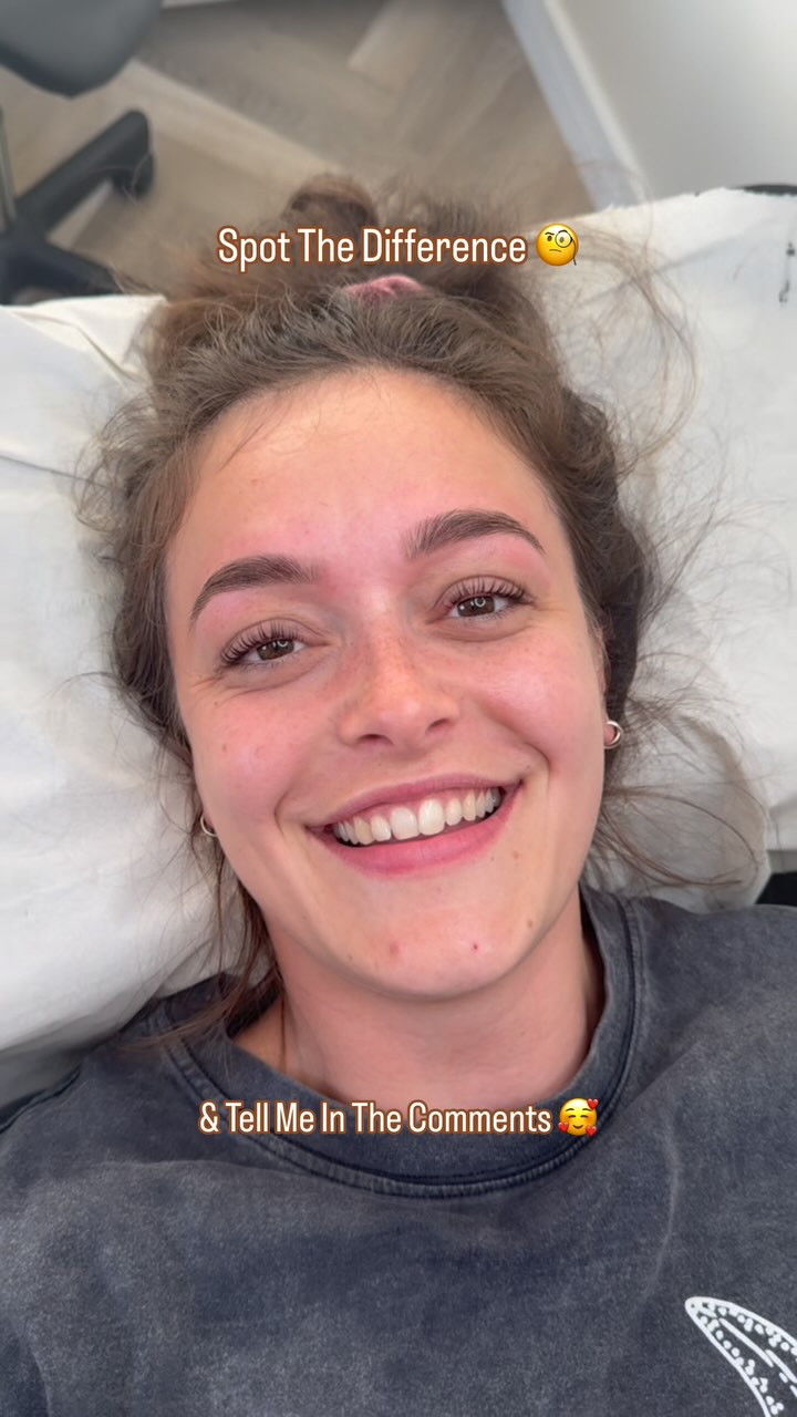 👀 Spot the difference… and no, it’s not a filter.
Just a little lash + brow magic ✨
Enhancing what’s already there.
And keeping it all looking super natural, just a bit more 💁♀️.
It’s the kind of difference that makes you feel fresher, brighter, and ready to take on the day without the faff.
No heavy makeup needed.
Just results that last.
So, what differences do you notice? Tell me in the comments 💬👇
#beforeandafter #lashes #brows #naturalenhancement #glowup #subtlebeauty #browandlashgoals #kingsteigntonbrows #newtonabbotlashes #nofilterneeded #confidenceboost #lowmaintenancebeauty #devonlashtech #browgoals #wakeupready