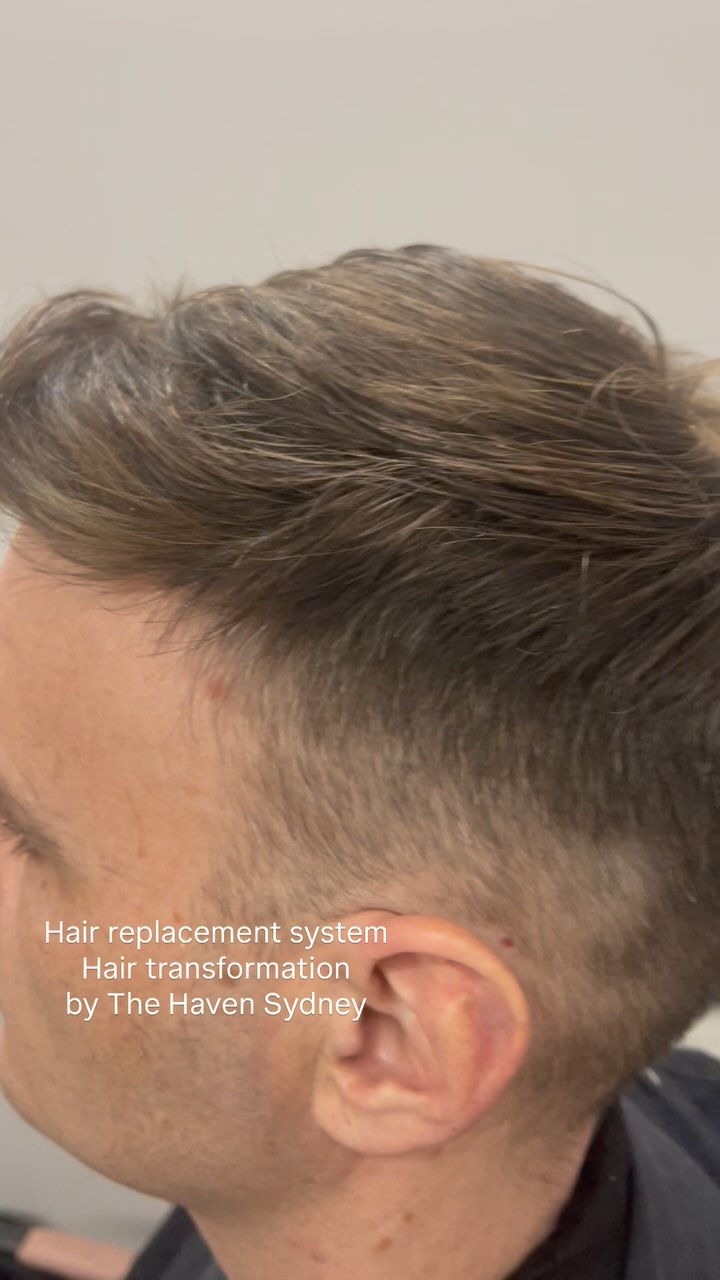#hairreplacementsystem #hairtransformation by @thehavensydney DM us to book your private consultation #malepatternbaldness #hairloss