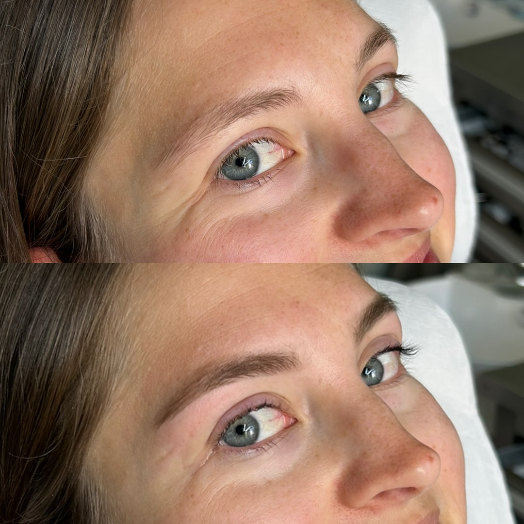 Brow + Lash Game: on point!
Vorher: müde 🥱
Nachher: wach, frisch & ready to shine 🪩💕
#browstyling #lashlifting #beforeandafter #freshlook #studioblueneburg #lueneburgbeauty #naturalbeauty