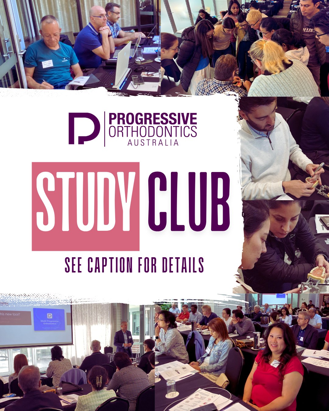 Our #StudyClub is filling up fast, and we don't want you to miss this opportunity. 📝😁 Get four free mentoring cases and hone your skills with bi-weekly Zoom meetings and dedicated WhatsApp chat for discussing cases.
This year-long club led by Dr. Brian Liao starts in August. Call Zita at ☎️+61 402 314 528 or email ✉️Zita@POSOrtho.net for more information.