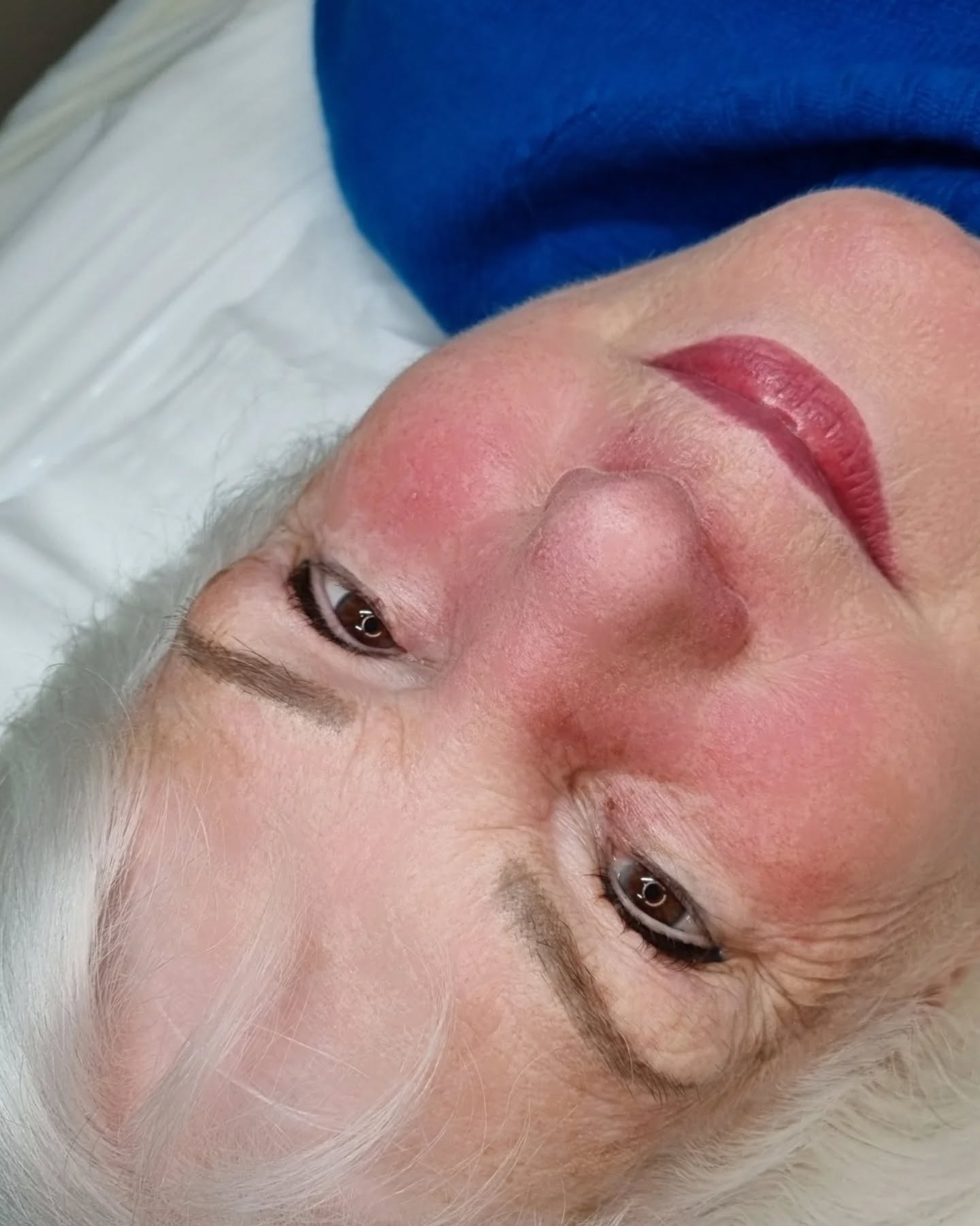 ✨️Healed Lipblush and fresh Upper Lashline Enhancement for my beautiful client - 83!✨️
Combination brows have settled in for a couple of years now and are still looking gorgeous.. I probably won't need to refresh them again for her. I worked with organics (carbon rich pigments similar to tattoo ink) they will just soften a little more over time.
I created a thicker eyeliner for her MANY years ago and she has a wide lashline with many rows of lashes so I just fillled inbetween the upper lashes this time to freshen it up and give her eyes some glamorous definition.
2nd picture is immediately post lip tattoo and pre lashline enhancement (how the old eyeliner tattoo looked)
I am so grateful to have such lovely clients who I have grown with over the years 🫶🏼❣️🥰
.
.
.
#permanentmakeupartist
#pmu #pmulips #pmubrows