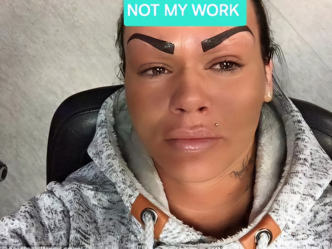 ๐ฉ Tattoo regret? Youโre not alone.
LI-FT saline solution can help safely and gently remove unwanted pigment.
โฅ๏ธBook your appointment today!
#FixOldInk #RemoveBadBrows #PMUSupport #BrowDoOver #LIftTattooSolution #Salinetattooremoval #colorcorrection #tattoo #tattooremoval #microbladingcorrection #correct #transformation #removal #lIftsaline #removemicroblading #salineremoval #pigmentlightening #removalpmu #tattooremoval #liftremoval #liftpigmentremoval #tattoo #microbladingcorrection #correct #badbrows #badtattoo #removal #botched #botchedbrows #eyebrowtattooing