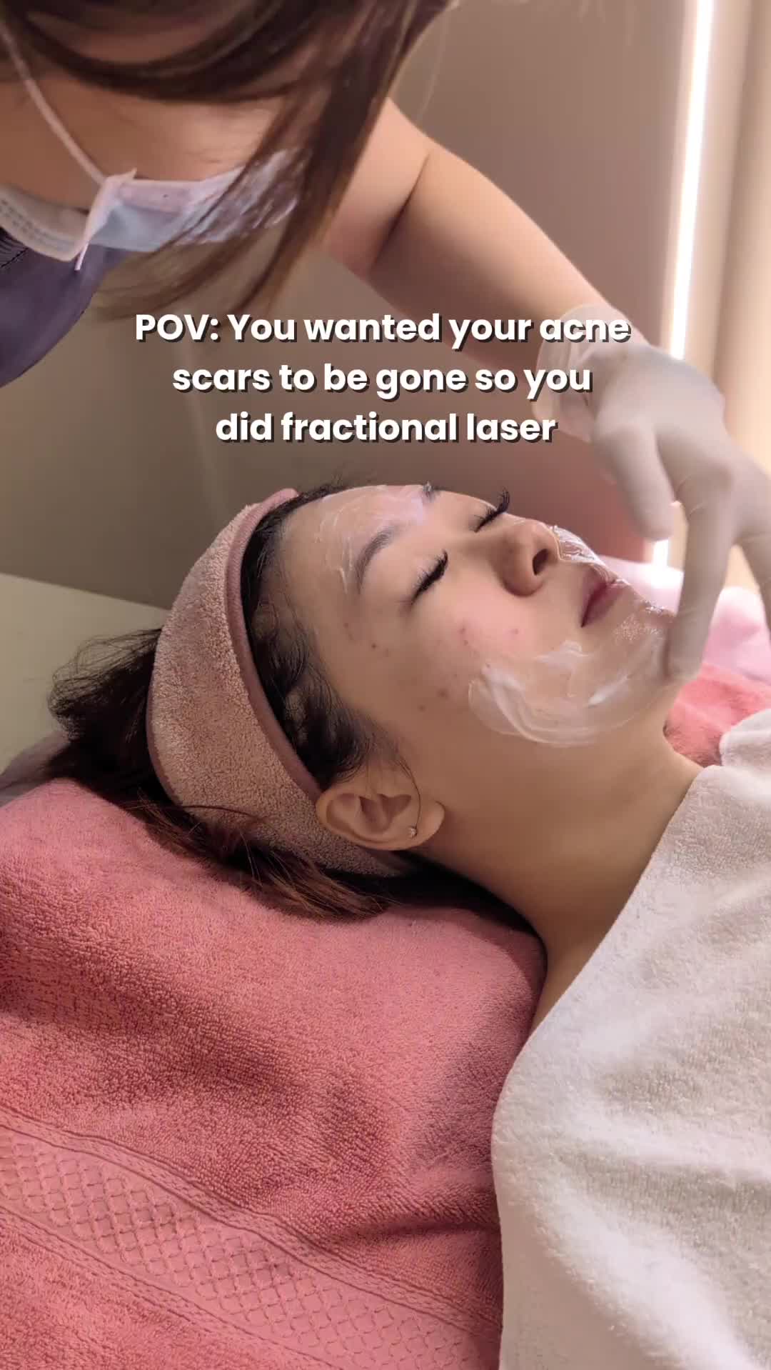 Can acne scars be treated with lasers?🧐
Yes, laser treatments, such as resurfacing or fractional lasers, can effectively improve the appearance of many types of acne scars by encouraging new, healthy skin to form.
While there may be a few days of mild redness or flaking as your skin heals and renews itself, many patients find the results well worth it in treating long-term acne scars. 💪🏻😉
Curious if laser treatment is right for you? Speak to our doctors for personalised advice!