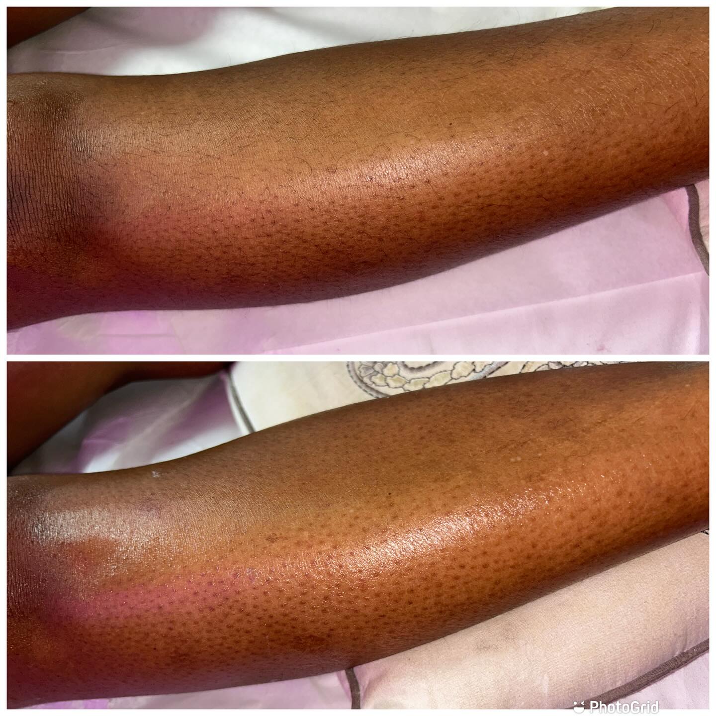 Are You FacingIT?!
✨ Facials | Waxing | Body Contouring | Yoni Steams | Sauna Blanket ✨
Come visit FacingIT in East Point, GA—your go-to destination for radiant skin, smooth results, and total body wellness. Whether you’re looking for a refreshing facial, expert waxing, advanced body contouring, or a relaxing yoni steam and sauna blanket session, FacingIT has you covered!
🌐 Book your appointment now at www.aubriafacingit.com
📍 Located in East Point, GA
We offer a variety of personalized services including:
💆♀️ Customized Facials
🧖♀️ Yoni Steams
🔥 Sauna Blanket Detox
🧴 Body Contouring & Wax Combos
🎁 Monthly Specials & Deals
Ready to glow? Click the link, book your service, and don’t forget to refer a friend while you’re there!
#Atlanta #AtlantaLife #AtlantaFood #AtlantaEats #AtlantaNights #AtlantaStyle #AtlantaArt #AtlantaPhotos #AtlantaPhotography #AtlantaStreets #AtlantaTimes #AtlantaLiving #AtlantaLifestyle #AtlantaMoments #AtlantaLove #PeopleOfAtlanta #AtlantaFashion #AtlantaMusic #AtlantaNightlife #AtlantaDaily #AtlantaFitness #AtlantaFit #AtlantaInfluencer
#AtlantaBlog #AtlantaShopping #AtlantaRestaurants #AtlantaFoodie #AtlantaAdventures #AtlantaVibes #AtlantaHomes