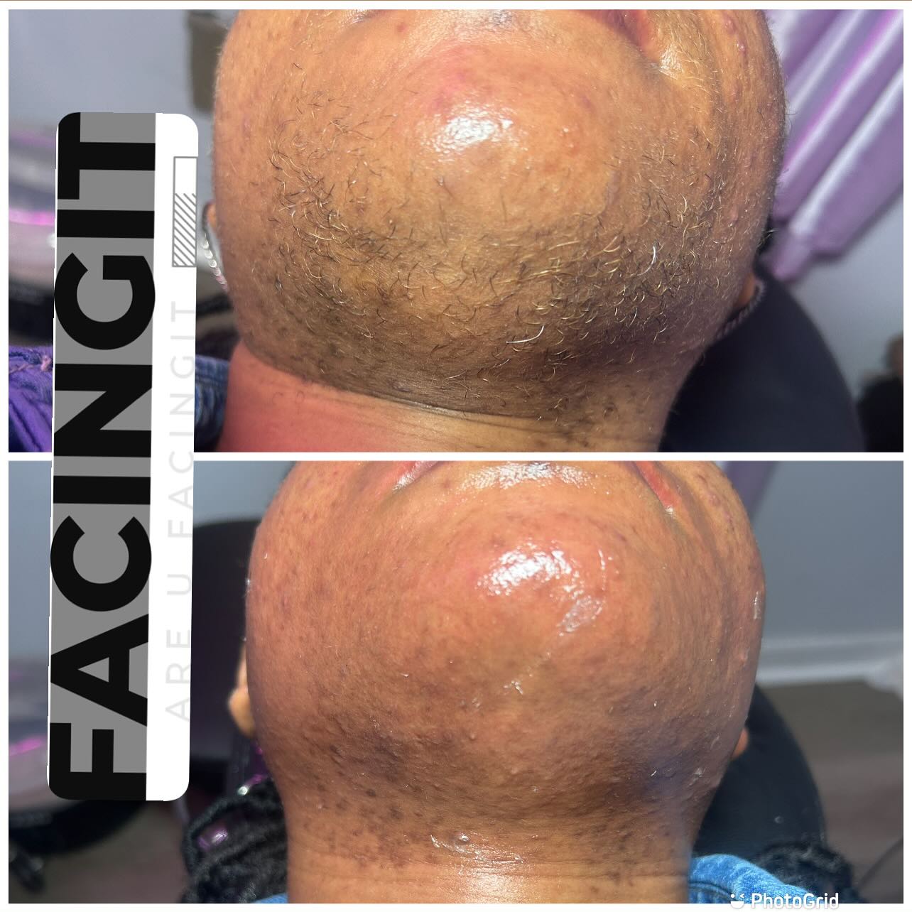 Are You FacingIT?!
✨ Facials | Waxing | Body Contouring | Yoni Steams | Sauna Blanket ✨
Come visit FacingIT in East Point, GA—your go-to destination for radiant skin, smooth results, and total body wellness. Whether you’re looking for a refreshing facial, expert waxing, advanced body contouring, or a relaxing yoni steam and sauna blanket session, FacingIT has you covered!
🌐 Book your appointment now at www.aubriafacingit.com
📍 Located in East Point, GA
We offer a variety of personalized services including:
💆♀️ Customized Facials
🧖♀️ Yoni Steams
🔥 Sauna Blanket Detox
🧴 Body Contouring & Wax Combos
🎁 Monthly Specials & Deals
Ready to glow? Click the link, book your service, and don’t forget to refer a friend while you’re there!
#Atlanta #AtlantaLife #AtlantaFood #AtlantaEats #AtlantaNights #AtlantaStyle #AtlantaArt #AtlantaPhotos #AtlantaPhotography #AtlantaStreets #AtlantaTimes #AtlantaLiving #AtlantaLifestyle #AtlantaMoments #AtlantaLove #PeopleOfAtlanta #AtlantaFashion #AtlantaMusic #AtlantaNightlife #AtlantaDaily #AtlantaFitness #AtlantaFit #AtlantaInfluencer
#AtlantaBlog #AtlantaShopping #AtlantaRestaurants #AtlantaFoodie #AtlantaAdventures #AtlantaVibes #AtlantaHomes