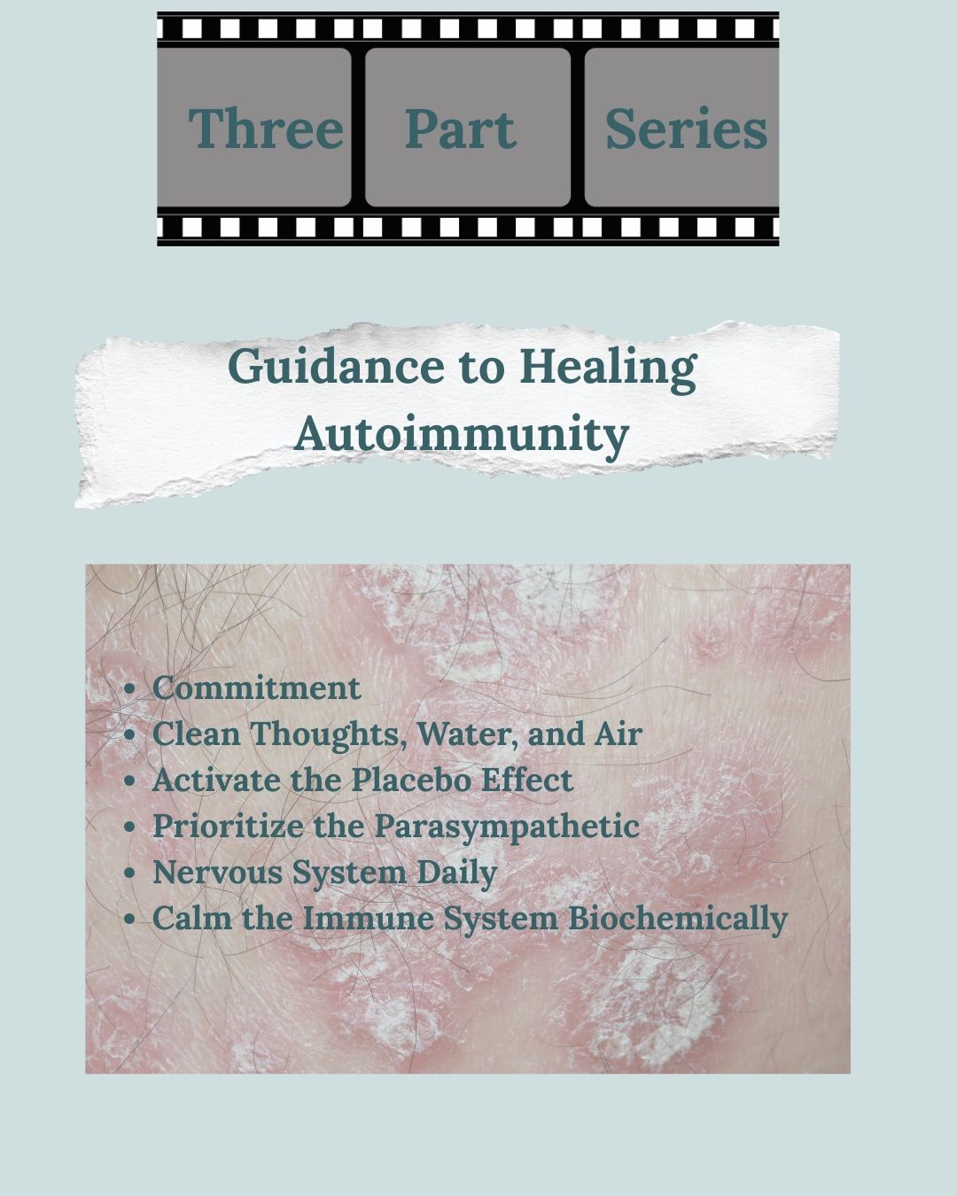 To heal autoimmunity through diet and lifestyle modification it takes steadfast dedication to disciplined diet and lifestyle choices for 12 months or more. It will depend on how long you’ve had a condition. Complete remission is not always possible but you can stop the progression and mitigate the risks of acquiring additional autoimmune diagnosis. It can take several months to see a reversal of symptom.
We all need clean thoughts, water, and air. Recall that we consume far more of these three than mere sustenance. Mindset and self talk matter, clean water filtered of toxins reduces our allostatic load and consider an air purifier to clean the air in your home.
It’s paramount that you foster a resilient belief in the body’s innate ability to heal and thrive. If you don’t think it’s possible to heal, you won’t.
You must prioritize engaging in practices such as meditation, mindful breathing, and gratitude.
And there are natural vitamins, minerals and supplements to consider incorporating like probiotics, specialized pro-resolving mediators (SPMs), and zinc that can calm the immune system. In functional nutrition counseling we focus on all the things all the time.