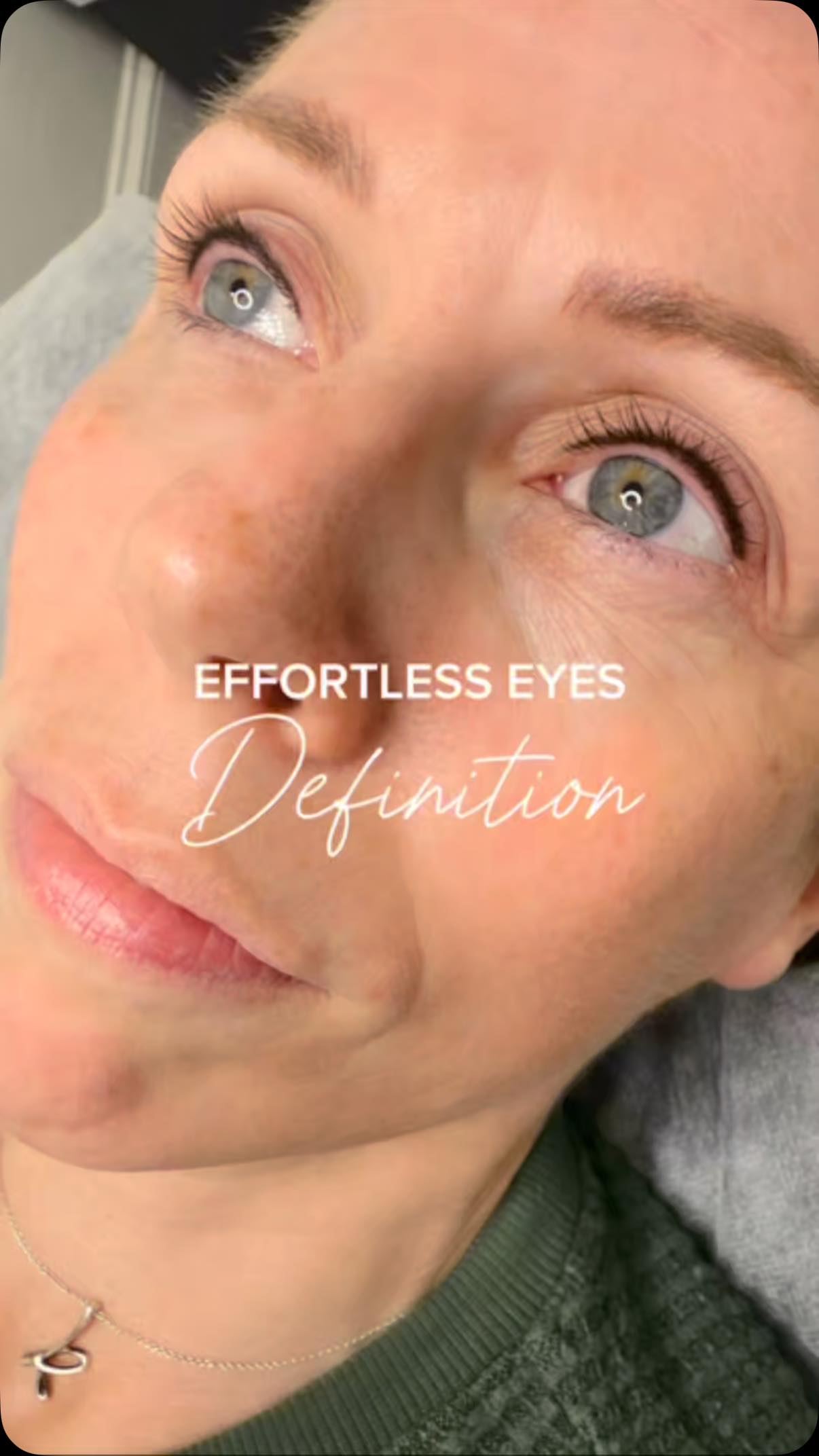 Tired of eyeliner smudging halfway through the day?
This is your sign to try Lashline Enhancement – the most natural way to define your eyes without looking “done.” 💉✨
Swipe to see the magic: before ➡️ after
No harsh lines, just a soft, fuller-looking lashline that enhances your natural beauty.
Perfect for everyday wear, gym-proof, sleep-proof, and always ready for a selfie. 📸
🔗 Book now and wake up effortlessly flawless.
📍 Dunia Ghabour Permanent Makeup Studio | duniaghabour.com
📞 203-444-6303
.
.
.
.
.
.
.
.
.
#LashlineEnhancement #WakeUpWithMakeup #PermanentMakeup #DuniaGaborStudio #NaturalBeauty #EffortlessGlam #CTBeauty #PMUArtist #SoftLiner #BeautyByDunia #LuxuryPMU #greenwichct