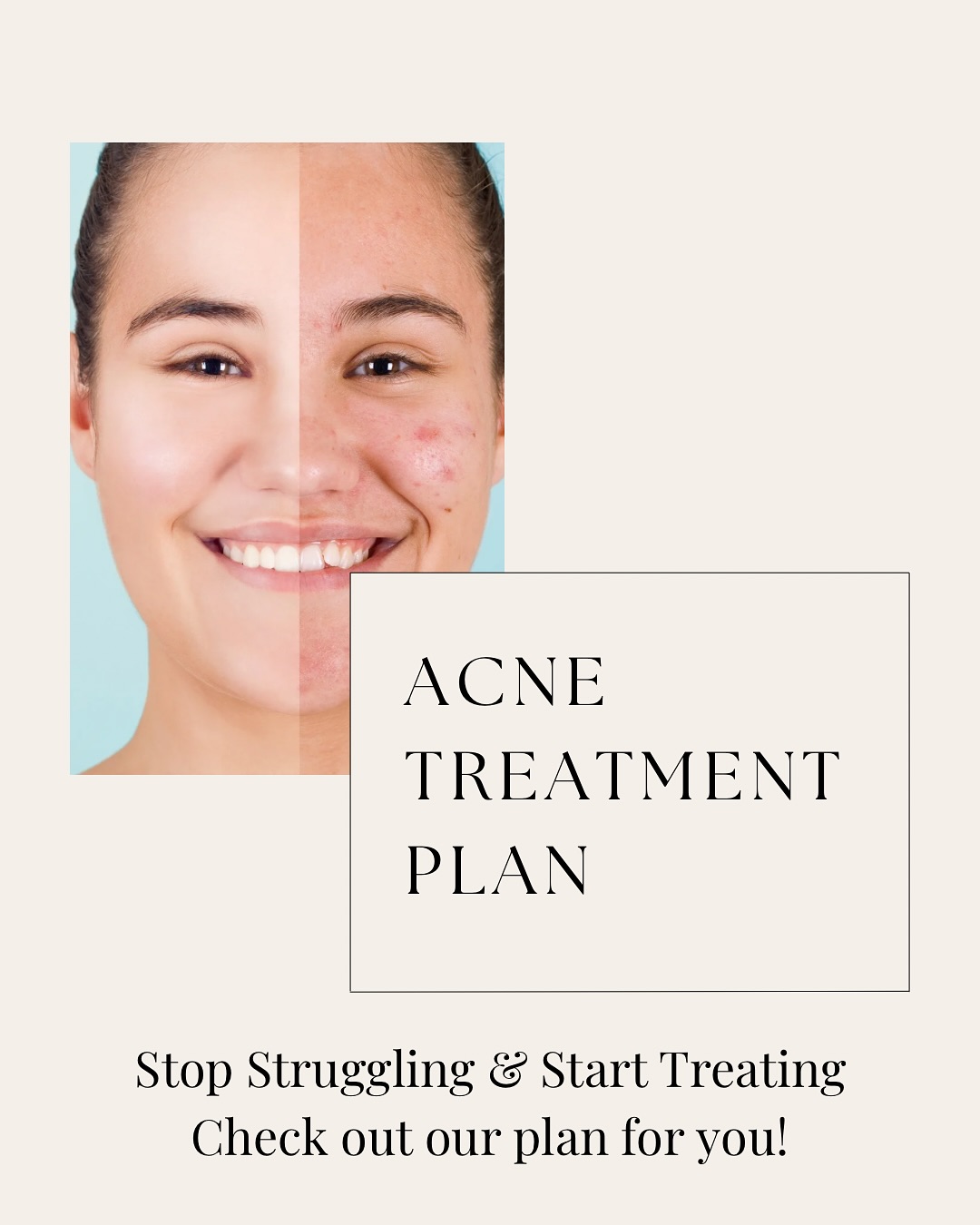 Unlock your path to clear, radiant skin with our comprehensive Acne Treatment Plan! ✨✨
Designed for all skin types, our plan combines clinically proven ingredients with personalized care to target acne at its source.
Book a free consultation with our experts to get the step by step plan and then decide if it’s right for you!!
Visit our site or click the link in our profile to book 🤍🤍
#acne #clearskin #acnetreatment #skincareroutine #loveyourskin #skincaretips #healthyskin #blemishfree #glowup #vaughanskincare