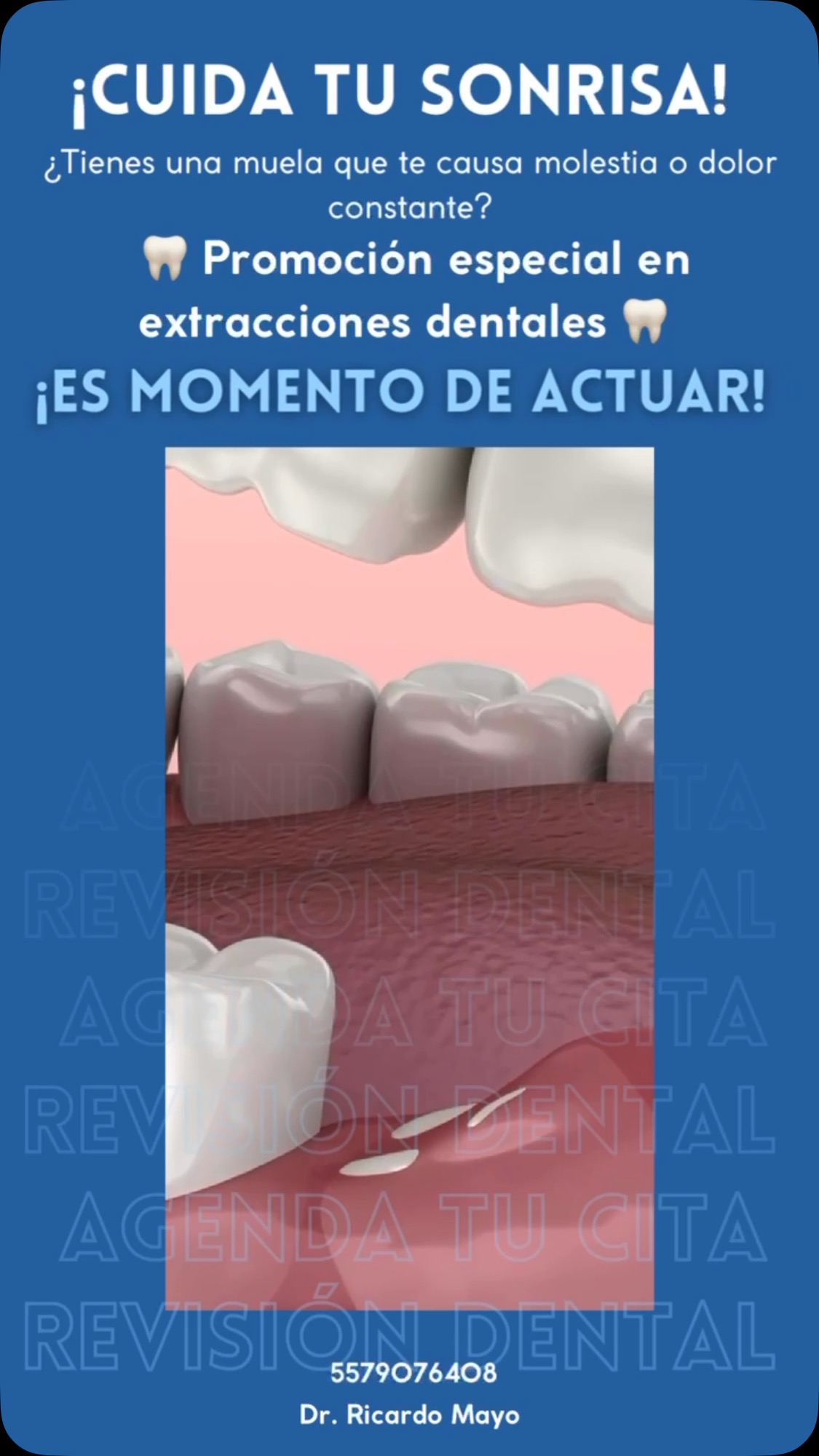 Esa molestia constante, esa muela que no te deja dormir, ese miedo que pospones…
Hoy es el día de hacer algo por ti.
💠 Extracciones y/o cirugías seguras
💠 Trato humano
💠 Resultados sin trauma
💠 Precio especial SOLO ESTE MES
💠 ¡Y un regalito sorpresa para los valientes!
🦷 Tu salud empieza por tu boca. Y nosotros estamos para cuidarla.