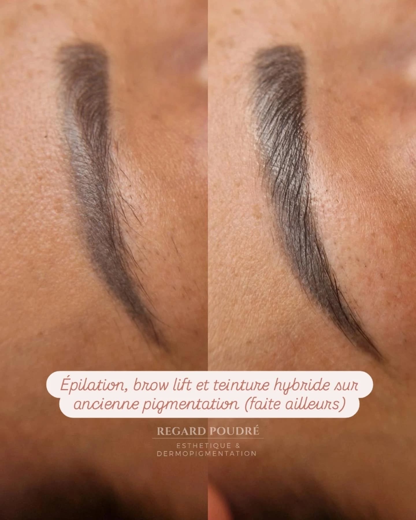 Epilation, brow lift et teinture hyrbide ✨️
Le brow lift permet de discipliner et rehausser les sourcils pour un effet plus fourni et soigné. On peut l’associer à une teinture hybride, qui colore les poils et la peau pour un résultat structuré et durable, comme un maquillage naturel 💕
Swipe ➡️
Pour plus de renseignements, contactez-moi !
📍 Salon privé à Homblières (02720), sur rendez-vous uniquement, du lundi au samedi.
📅 Pour prendre rendez-vous :
📞 06 49 57 28 05
📩 Par message privé sur les réseaux sociaux
#browlift #beautéduregard #sourcilsrehaussés #teinturehybride #epilationsourcils #Homblières #aisne #hautsdefrance