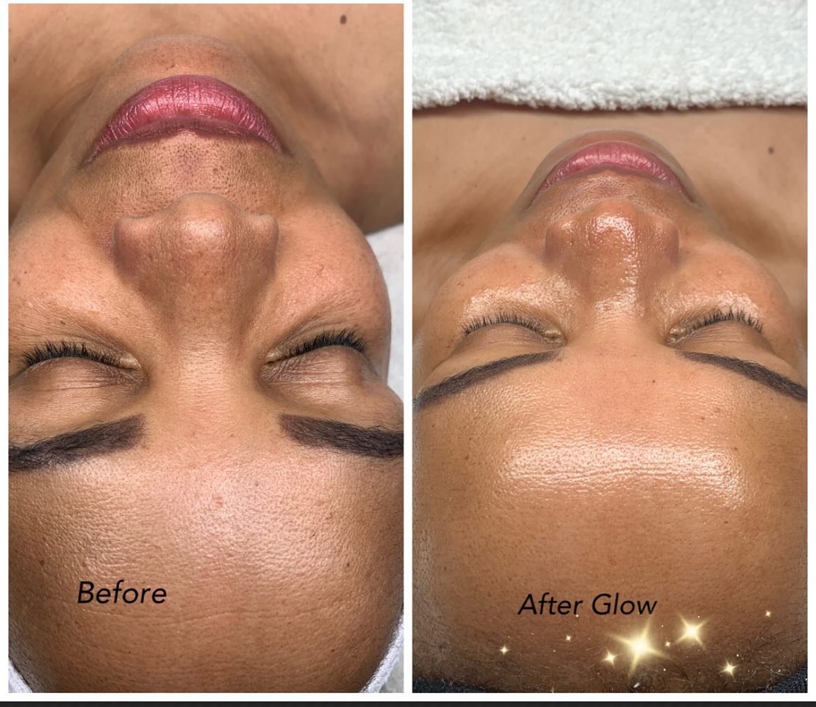 ✨Your best skin starts in Parkhurst✨
• We’re welcoming new clients with a glow-up gift:
R550 First Time Facial Client• Luxurious • Skin deep confidence 😉 . Contact link in Bio. #skin food#facial#Hydration#Winterglowup##glowskin#parkhurst